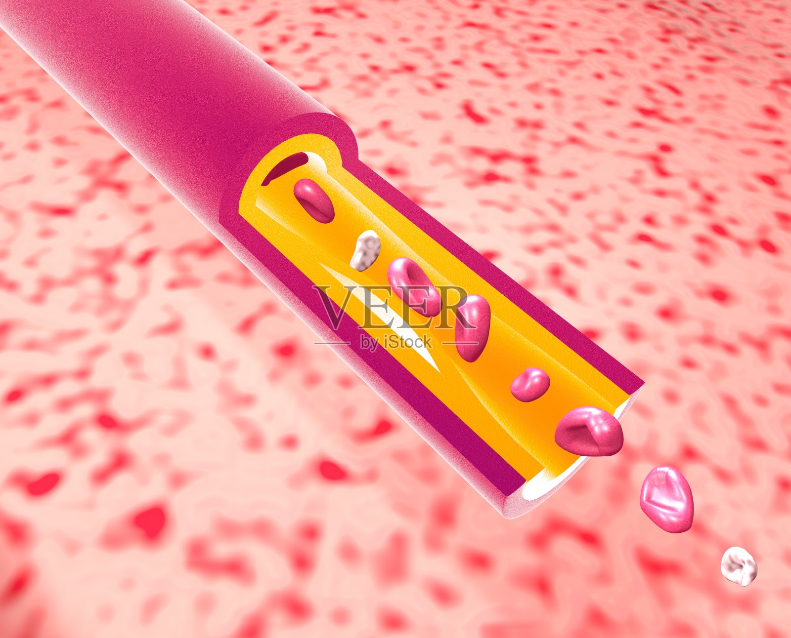 脂肪阻塞的动脉毛细血管三维解剖图。照片摄影图片