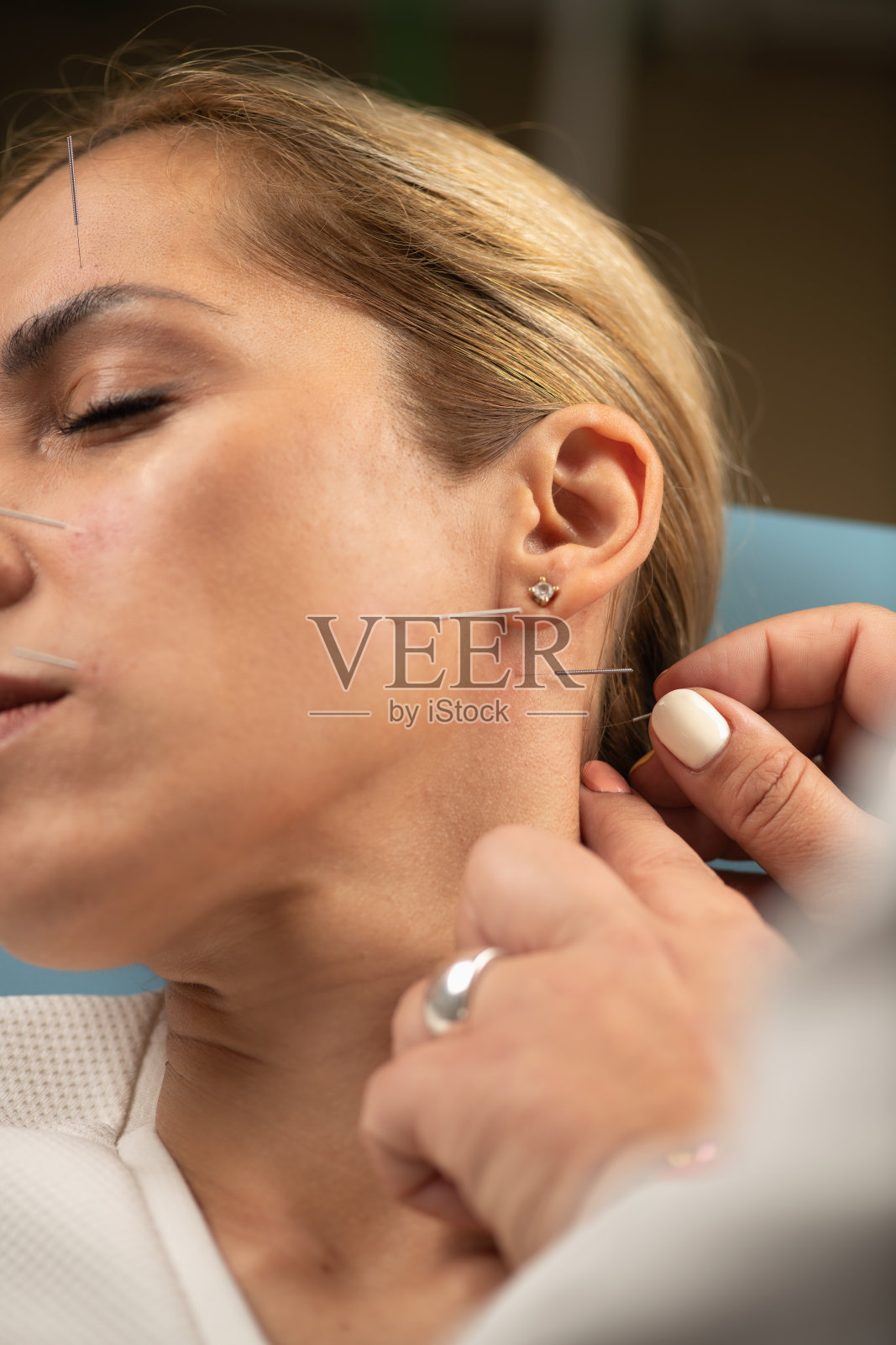 神经针刺治疗女性患者面部照片摄影图片