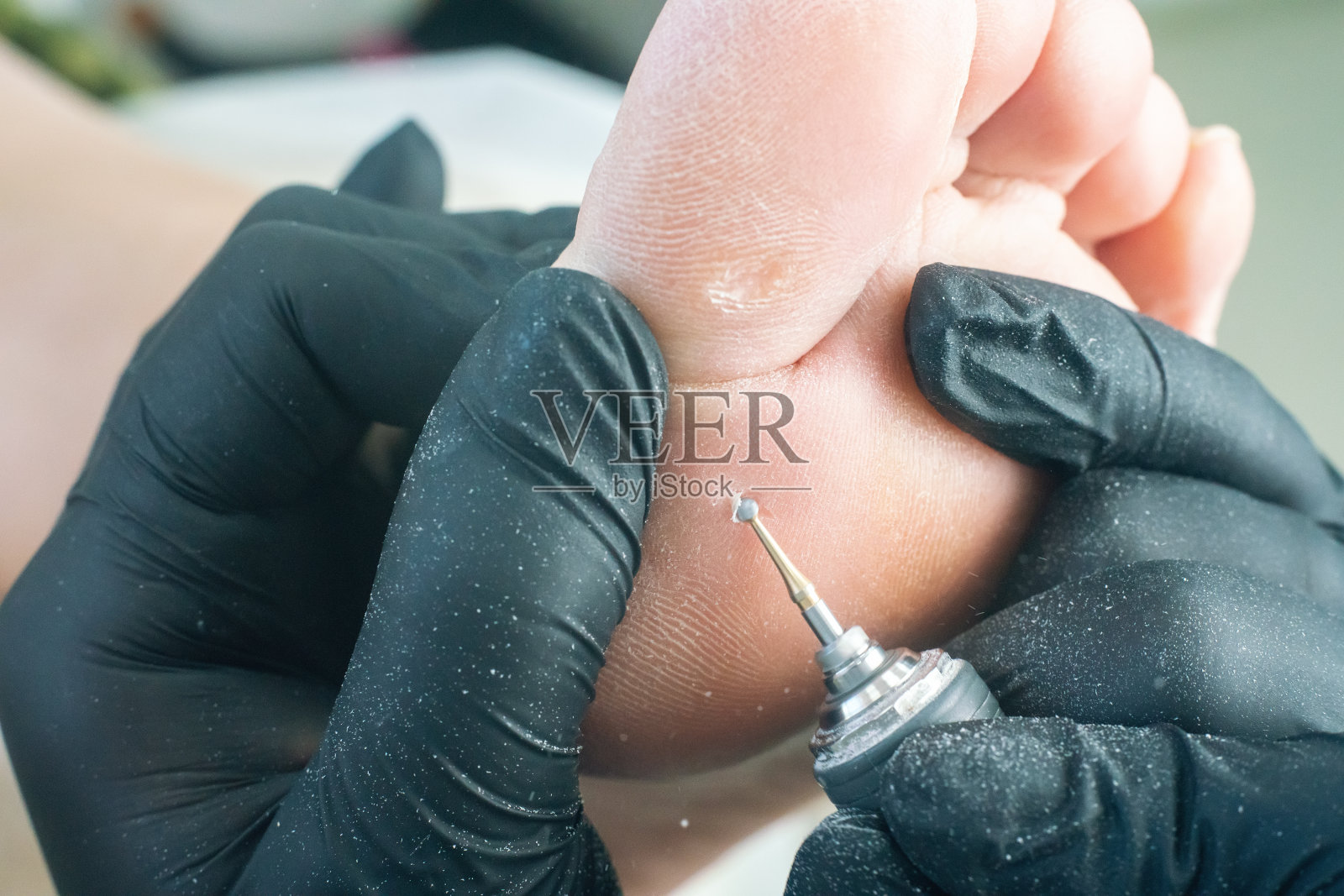 一名足科医生用电动足疗钻为一名妇女去除脚上的老茧照片摄影图片