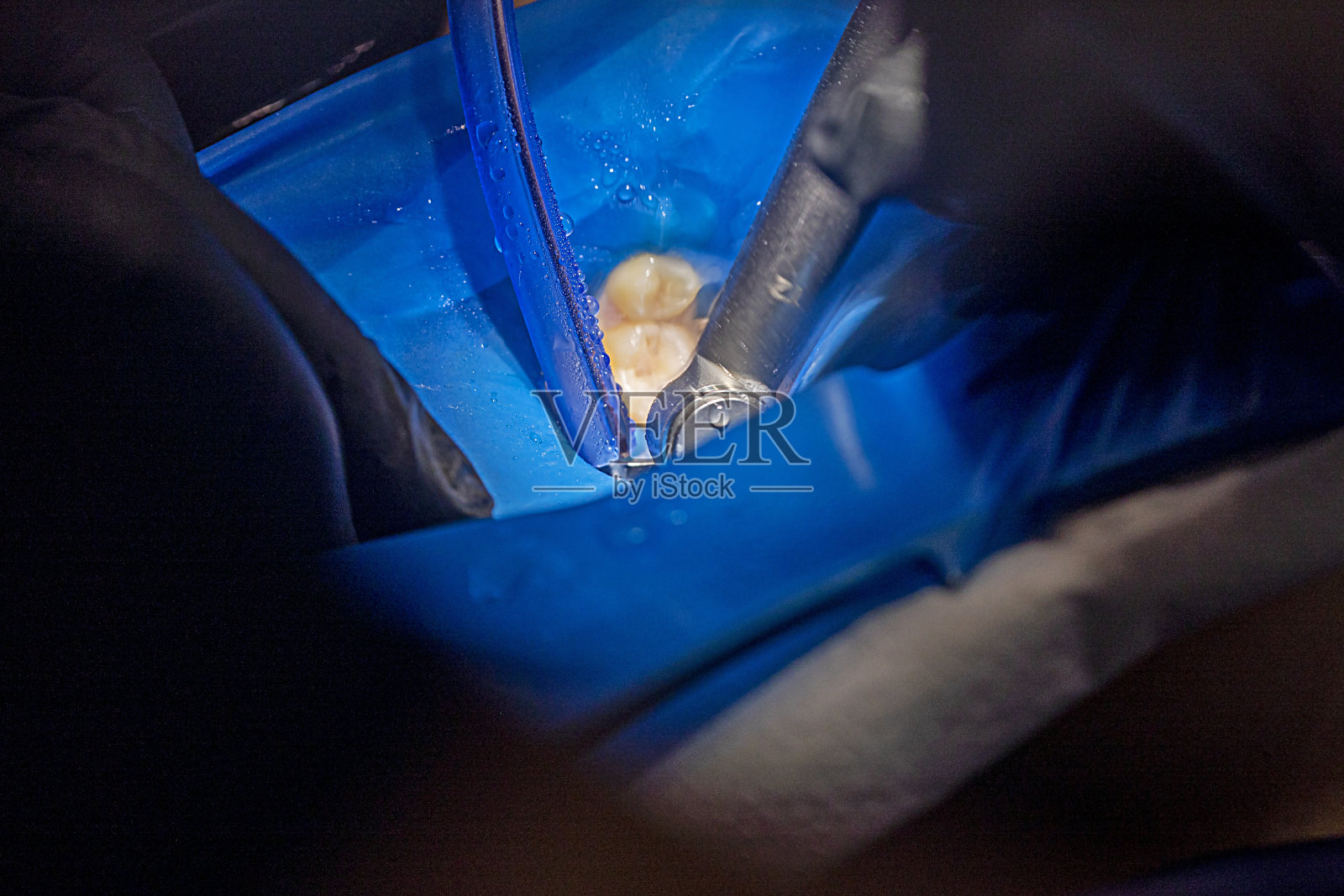 在牙医那里修复损坏的牙齿爱护和护理牙齿照片摄影图片