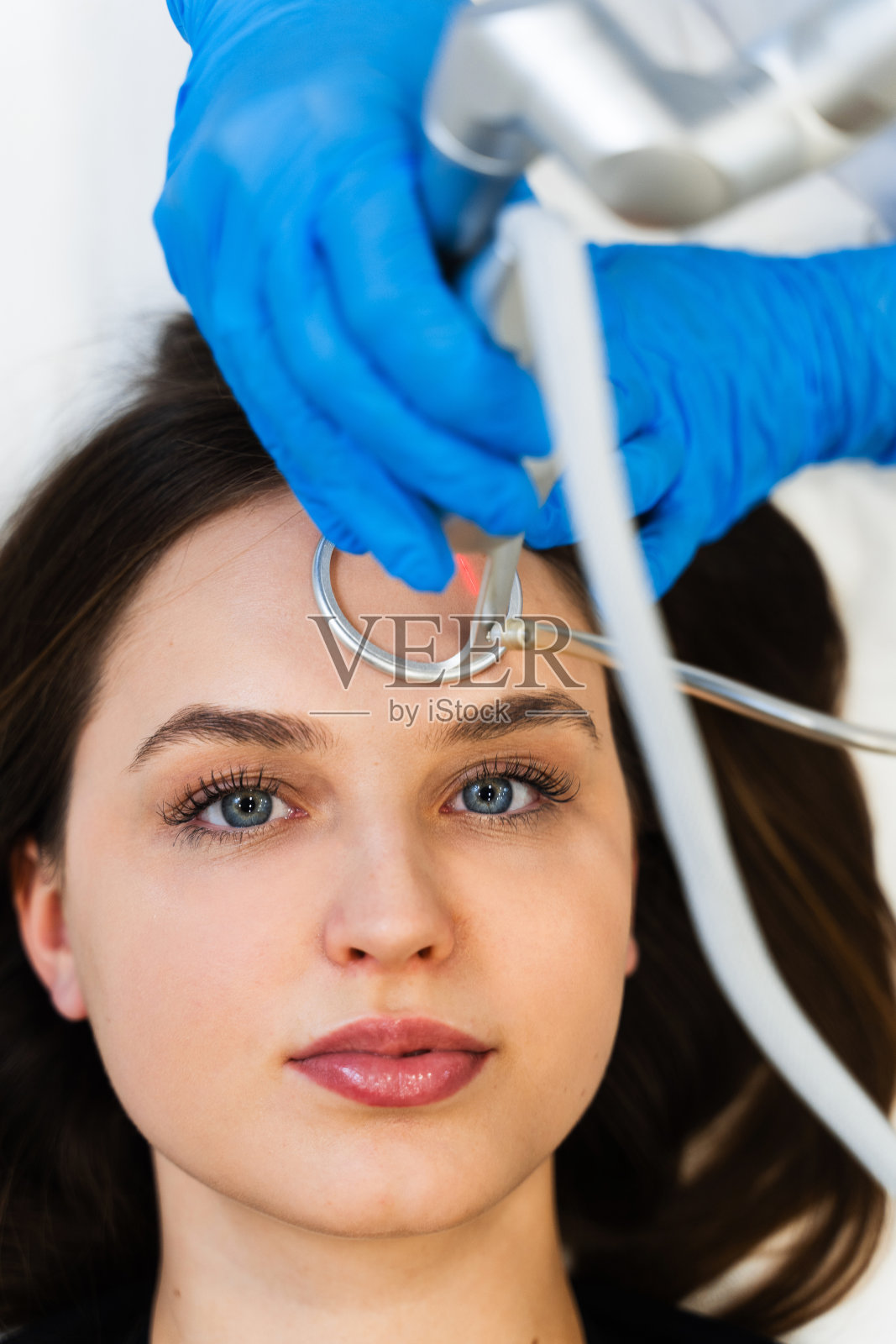 通过CO2激光表面修复去除皱纹和疤痕。激光护肤程序。照片摄影图片