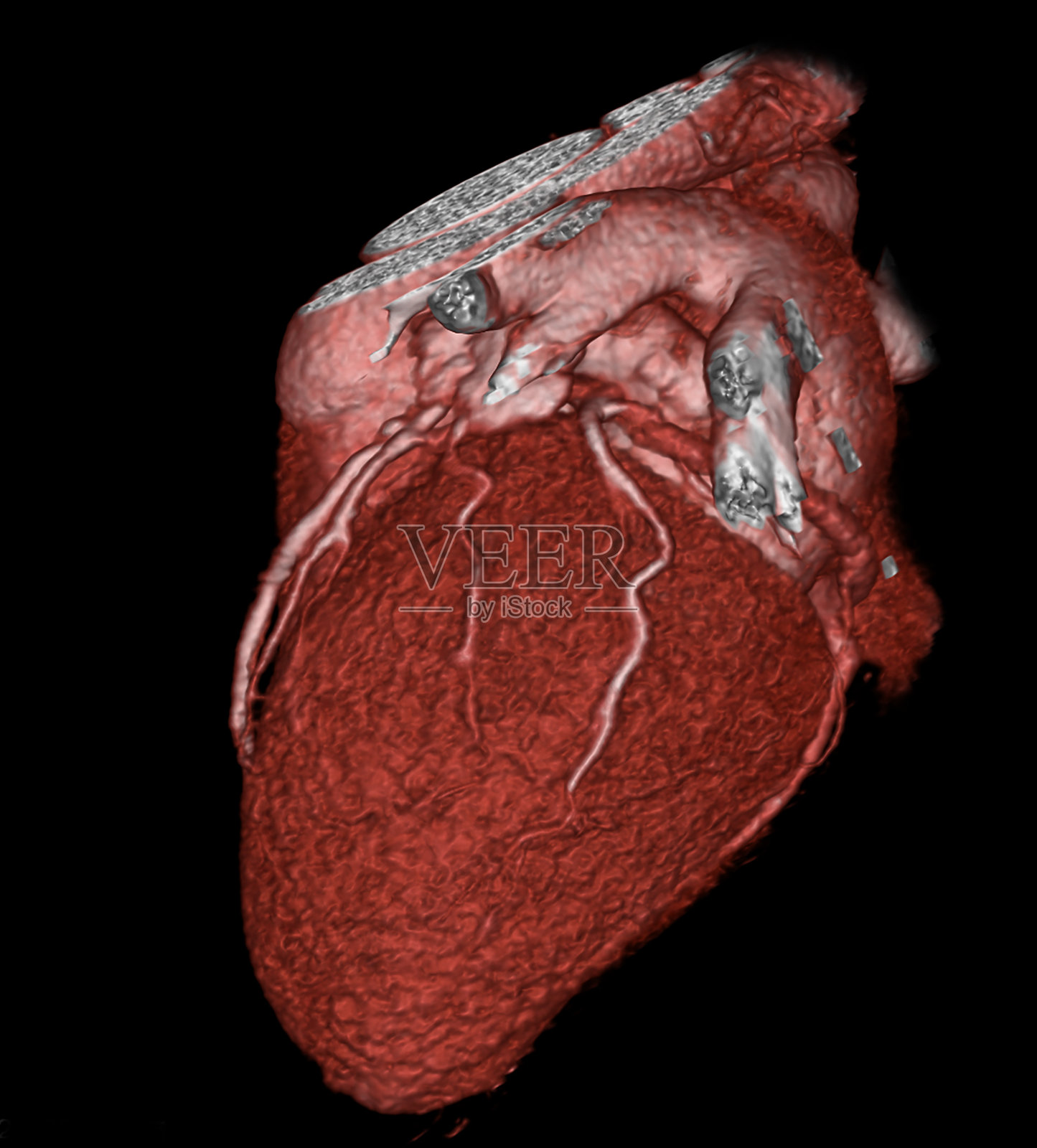 Mri和ct扫描成像照片摄影图片