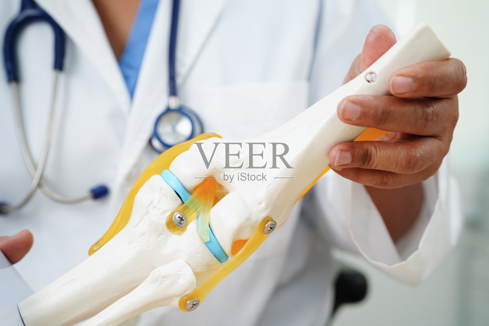 膝关节骨性关节炎，医生展示膝关节矫形模型。照片摄影图片