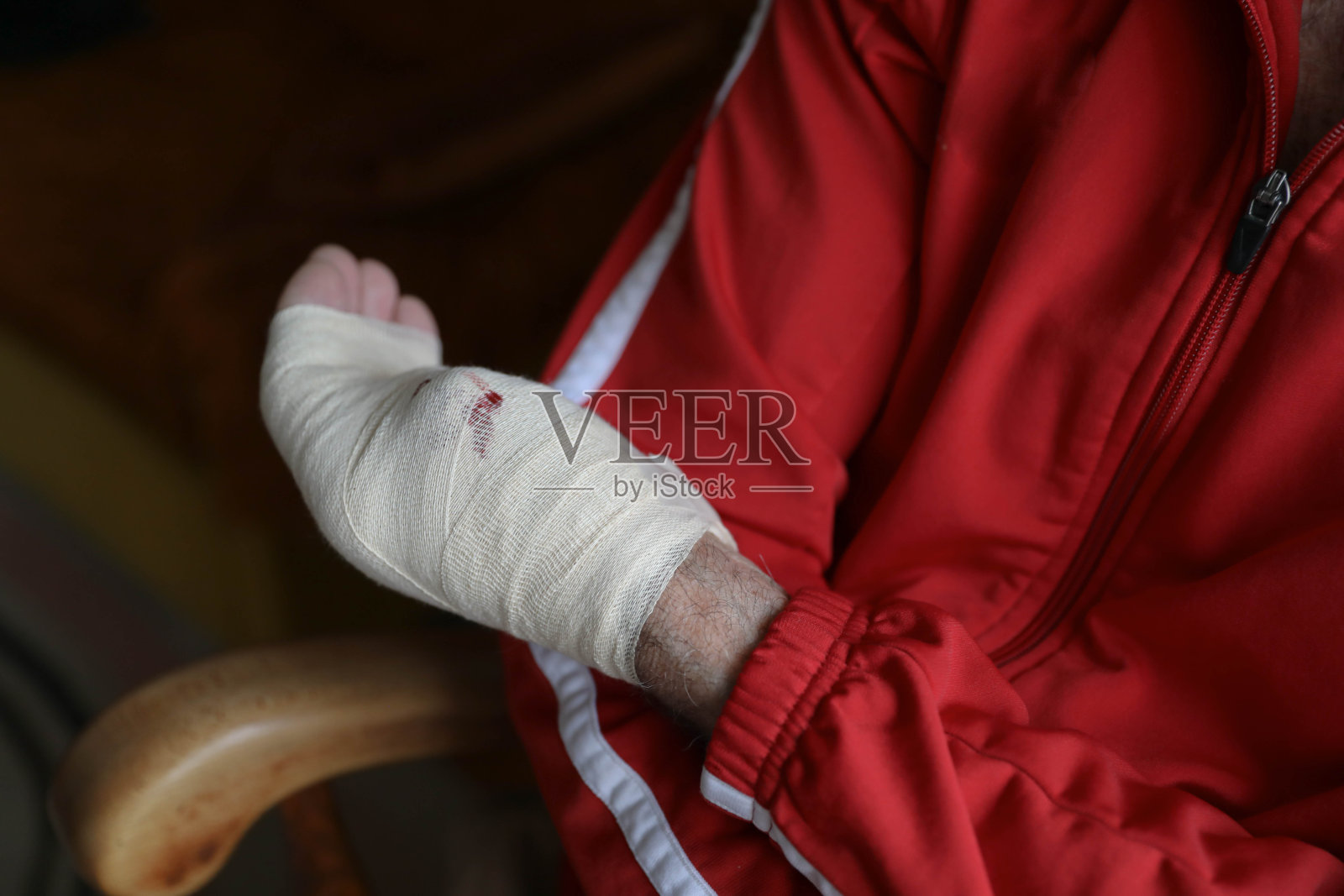 一个手部受伤的老人，拇指不见了。他的手缠着绷带，看上去很担心照片摄影图片