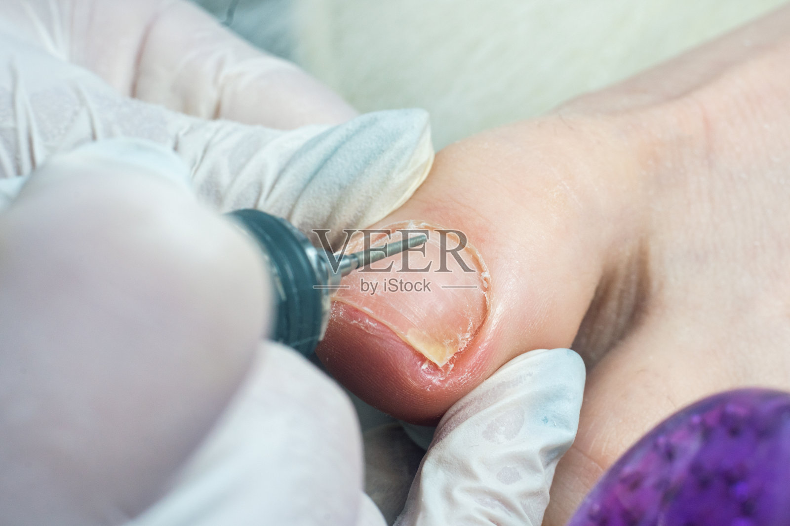 专业五金足疗师，足疗师使用磨甲机清洗指甲照片摄影图片