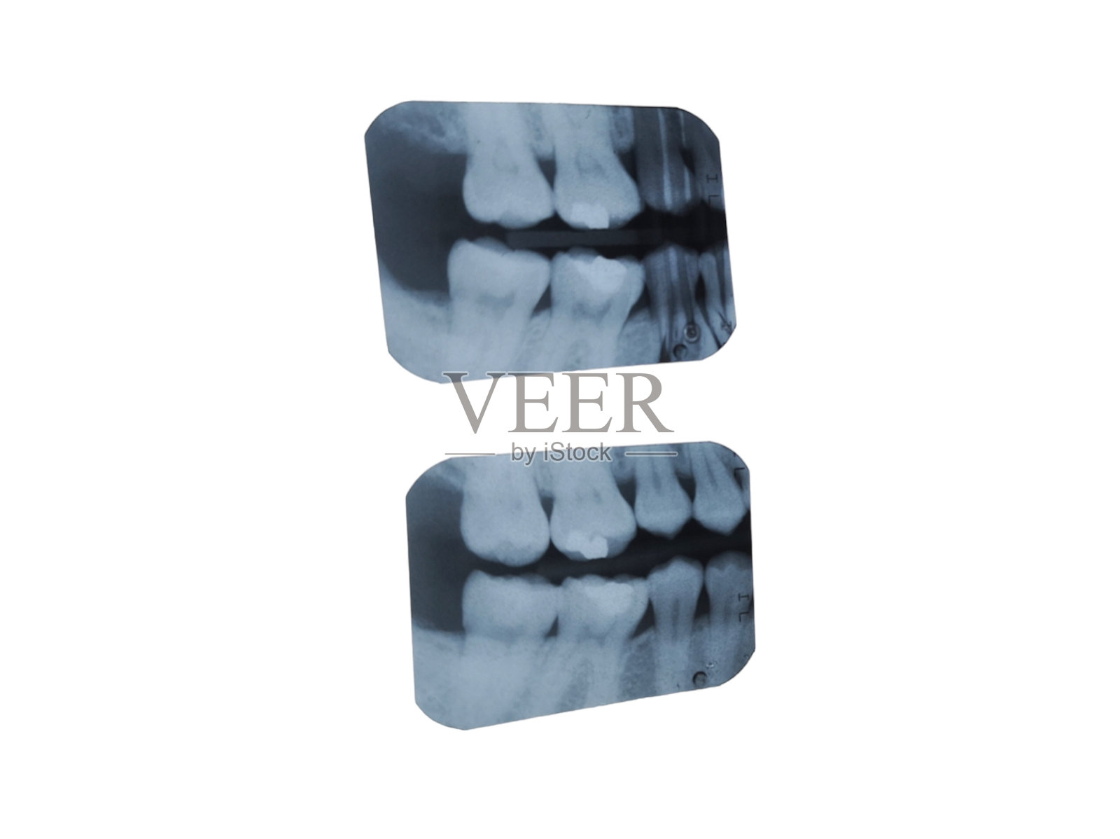 白色背景的牙科x光片。牙齿x光片。牙齿健康照片摄影图片