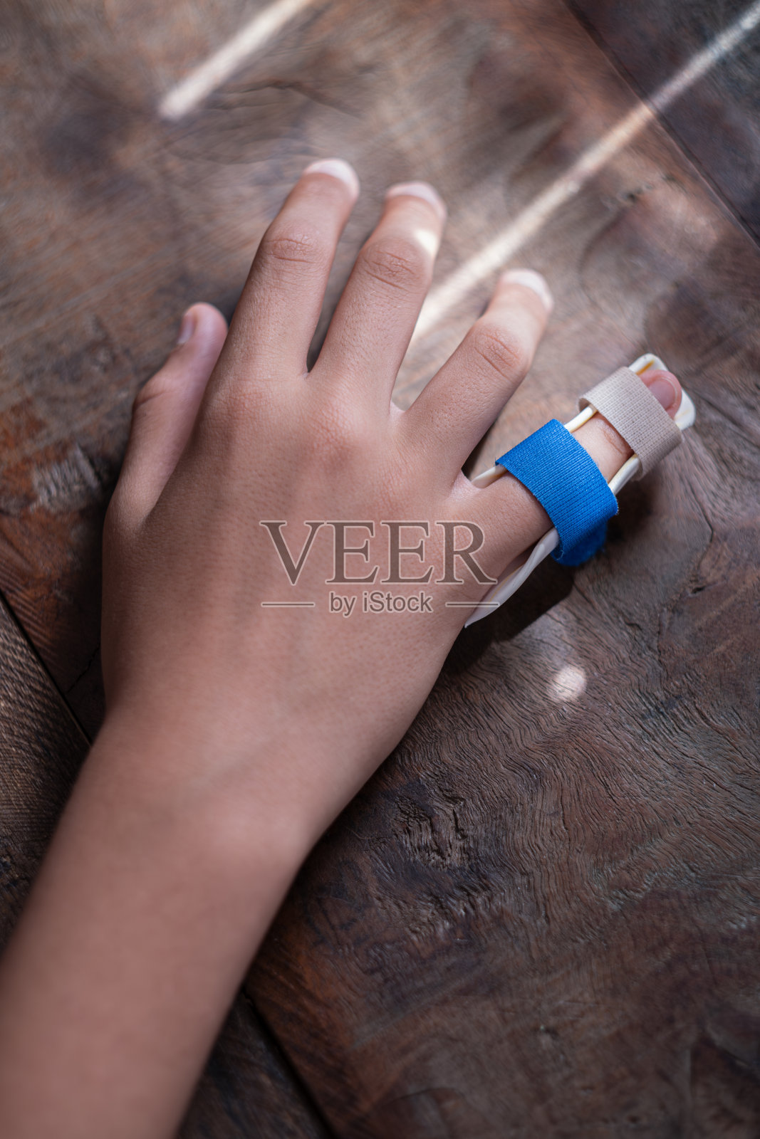 用夹板治疗手部小指关节脱位。照片摄影图片