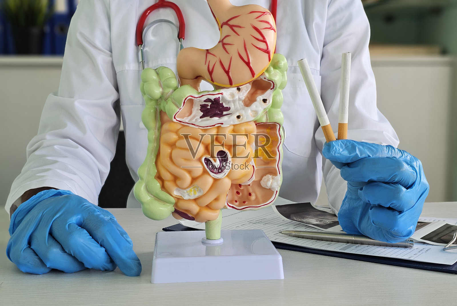 医学专业人员在临床环境中演示吸烟对消化系统模型的影响照片摄影图片