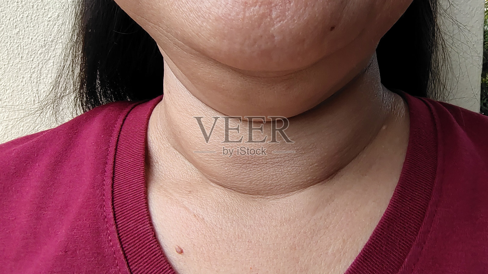 颈部的松弛和脂肪。照片摄影图片