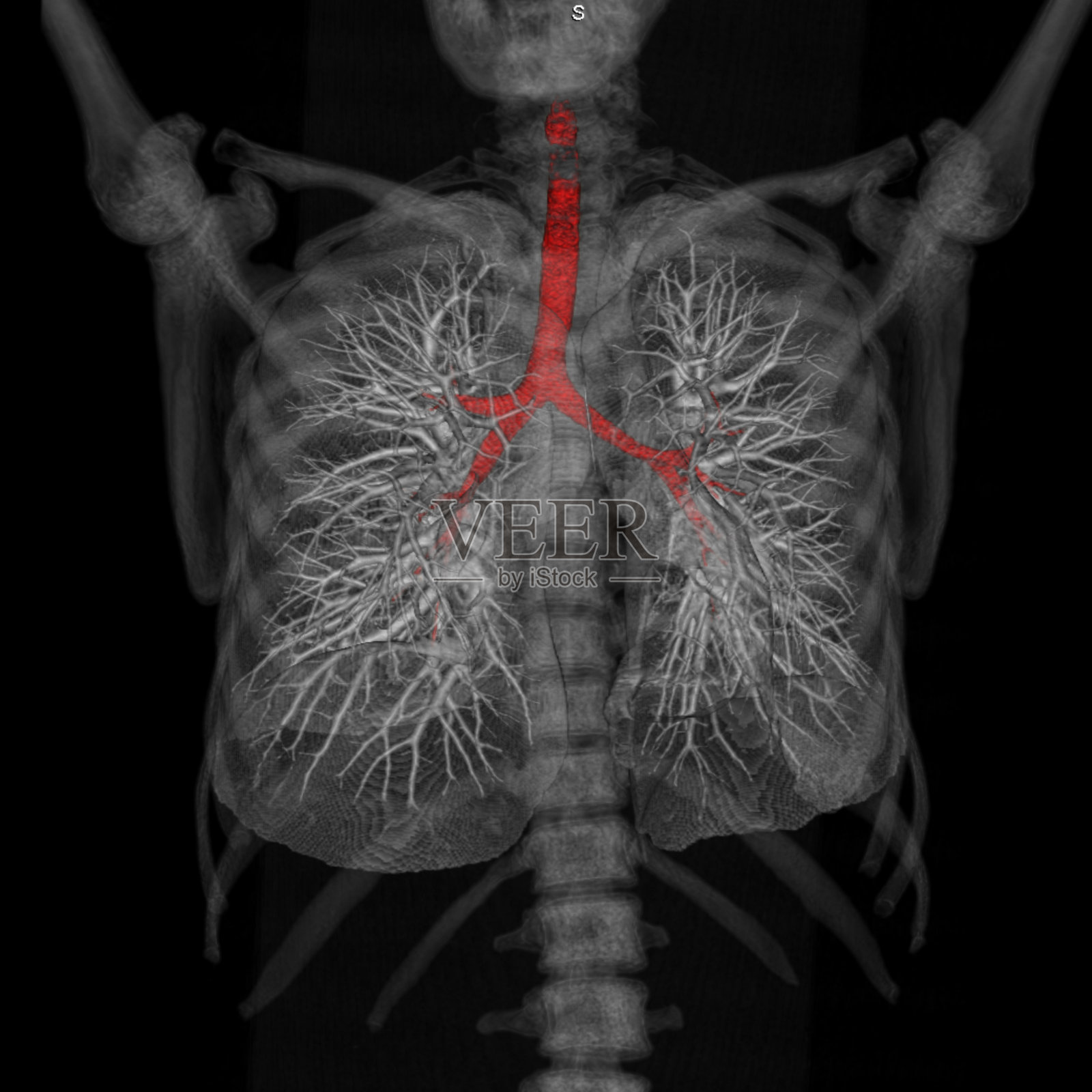 胸部或肺部CT或MRI 3d扫描照片摄影图片