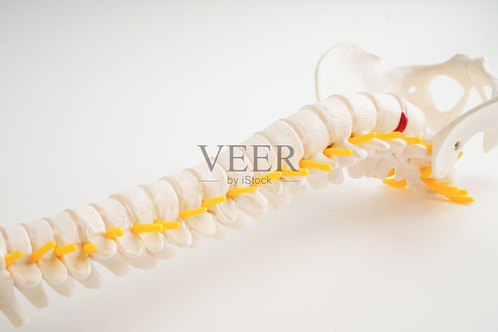 脊神经与骨，腰椎移位椎间盘突出碎片，骨科治疗医学模型。照片摄影图片