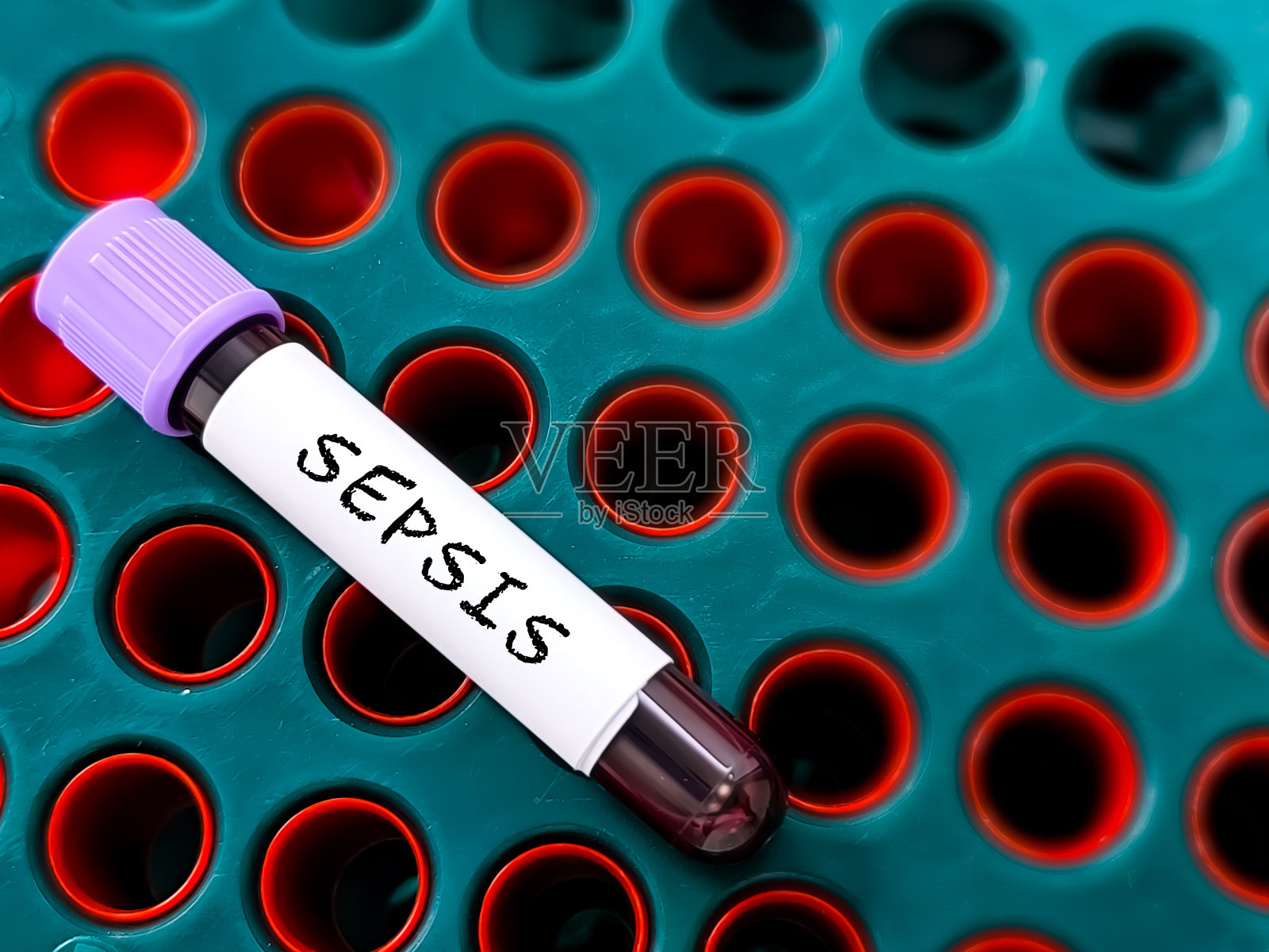 脓毒症。败血症是一种严重的危及生命的疾病，当身体的免疫系统对感染产生极端反应时，就会发生这种情况。照片摄影图片