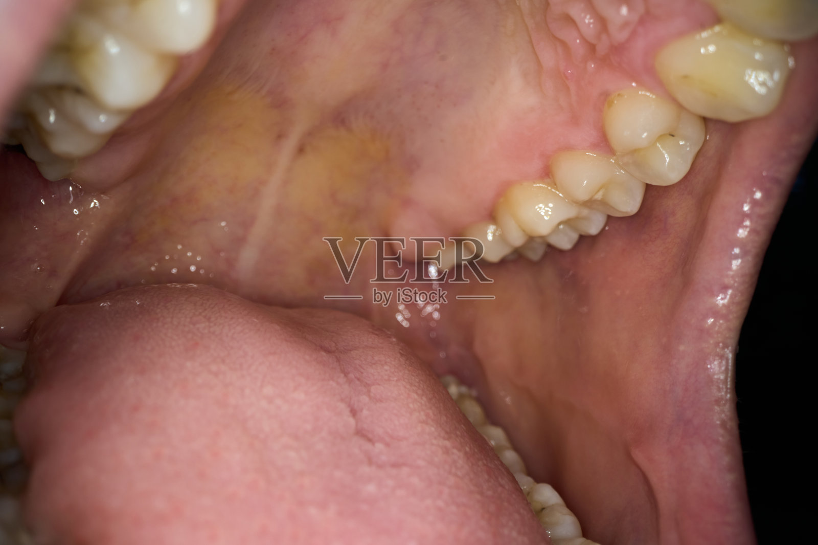 缝合年轻女子的牙齿照片摄影图片