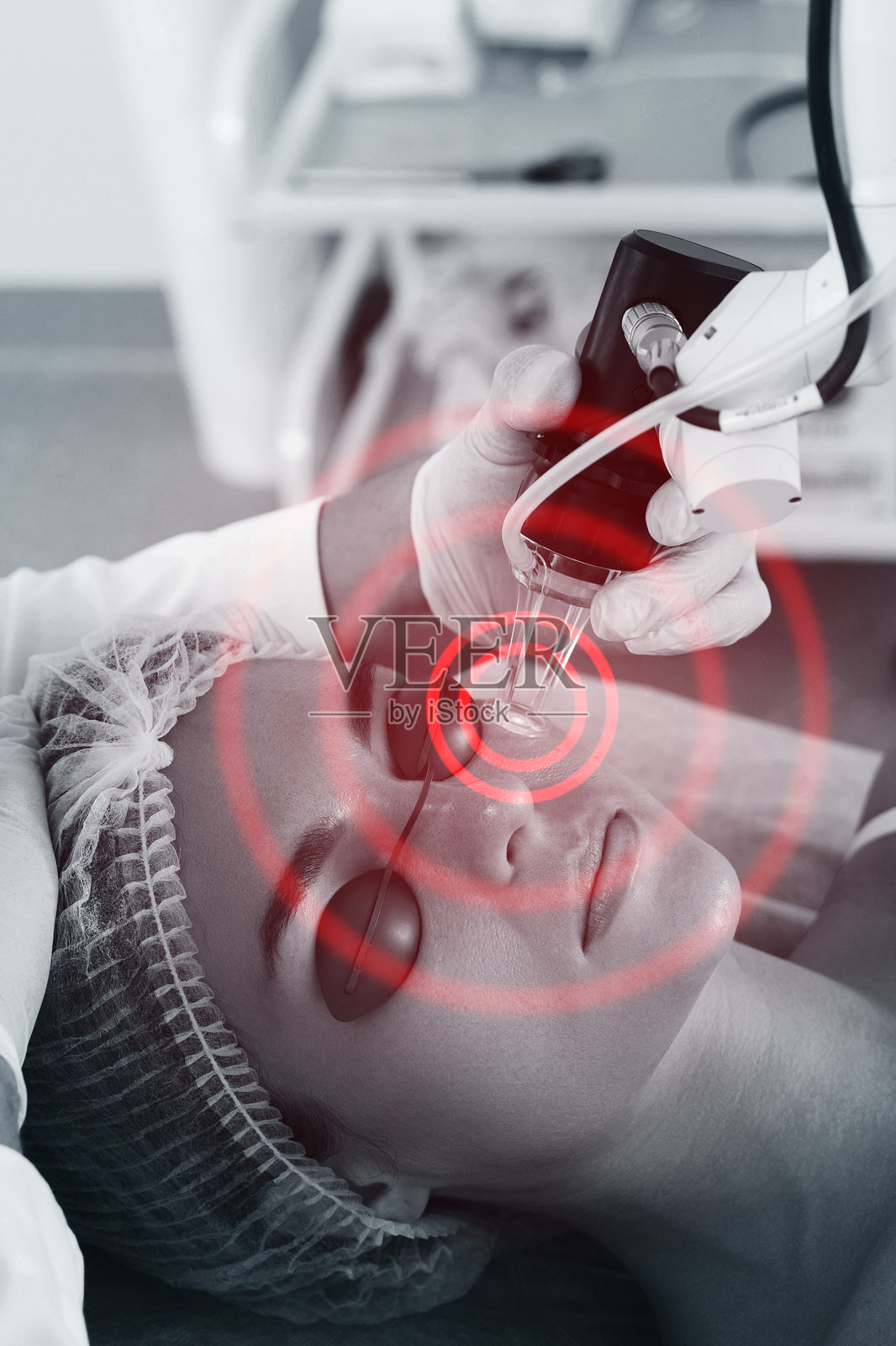 医生皮肤科医生和女性客户在激光皮肤换肤治疗照片摄影图片