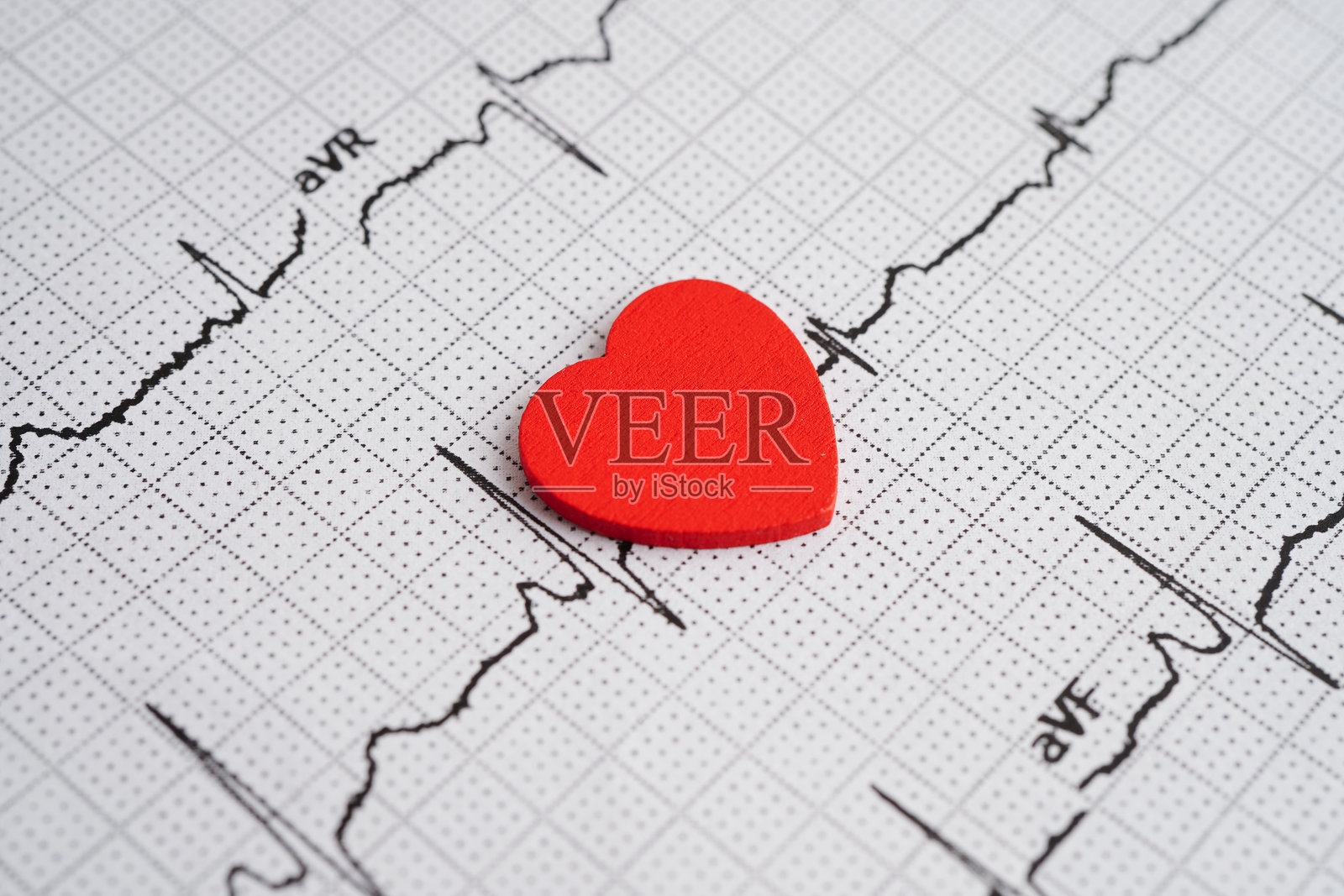 心电图，心波，心脏病发作，心电图报告。照片摄影图片