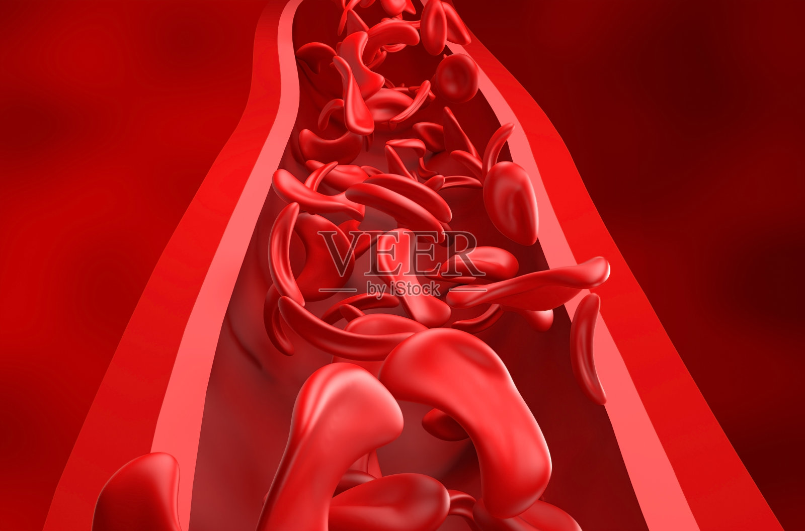 镰状细胞贫血-正面视图3d插图照片摄影图片