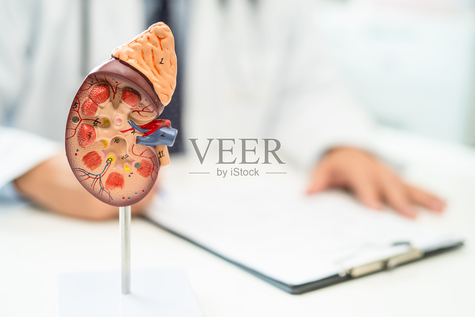 肾脏疾病，慢性肾脏疾病ckd，医生用人体模型在医院进行研究和治疗。照片摄影图片