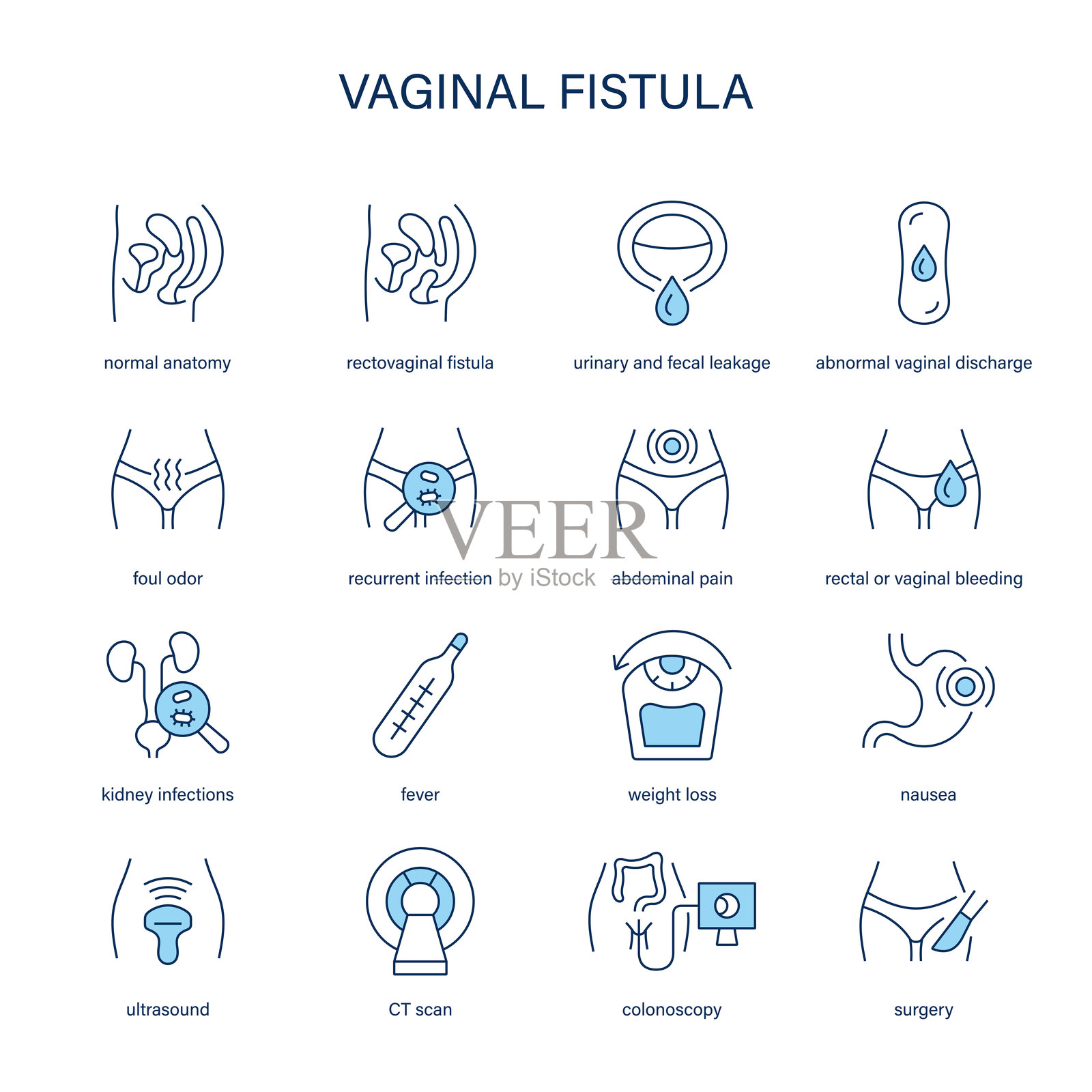 阴道瘘症状，诊断和治疗矢量图标。医疗图标。插画图片素材