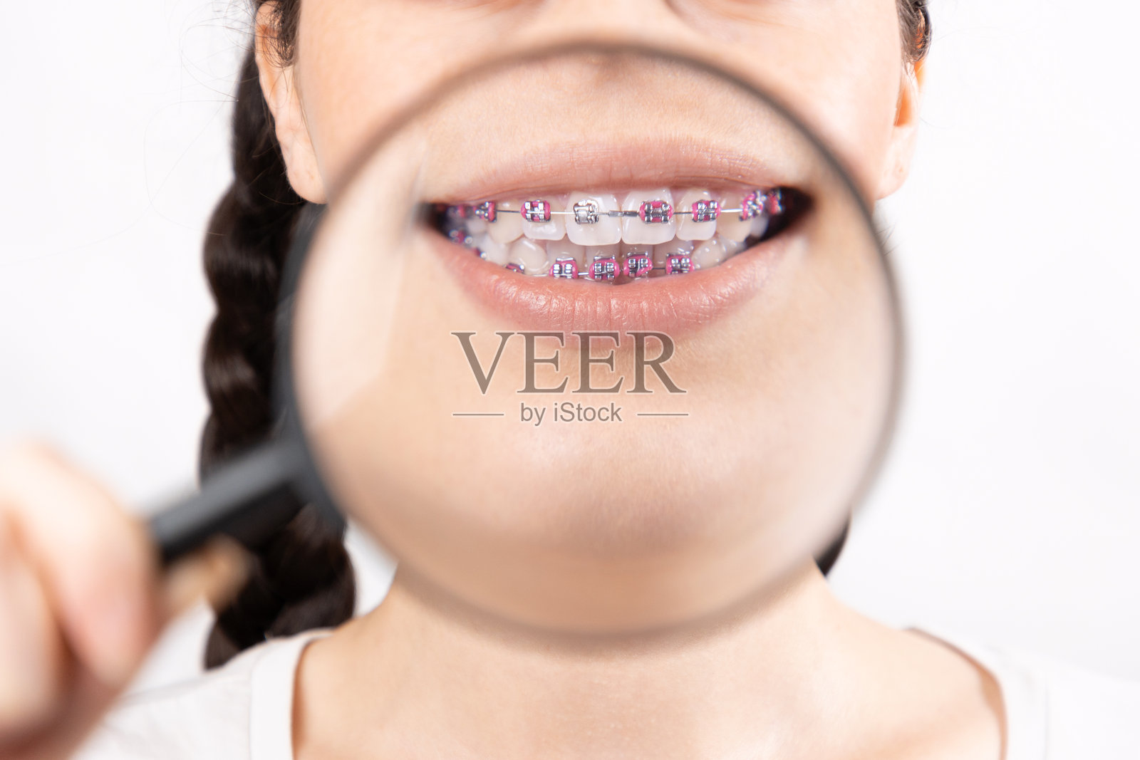 微距拍摄的微笑女性面孔，牙齿上戴着牙套，通过放大镜放大。白色背景。正畸治疗的概念。照片摄影图片