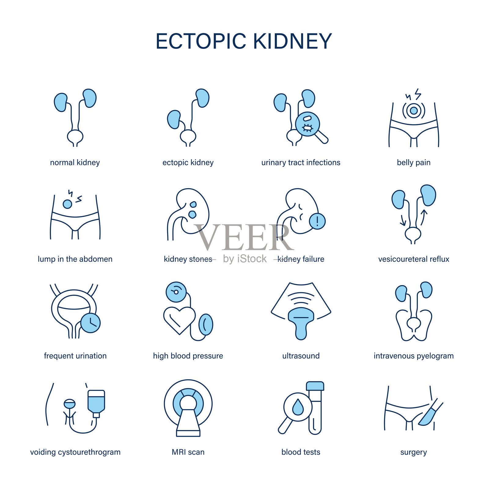 异位肾症状，诊断和治疗矢量图标。医疗图标。插画图片素材