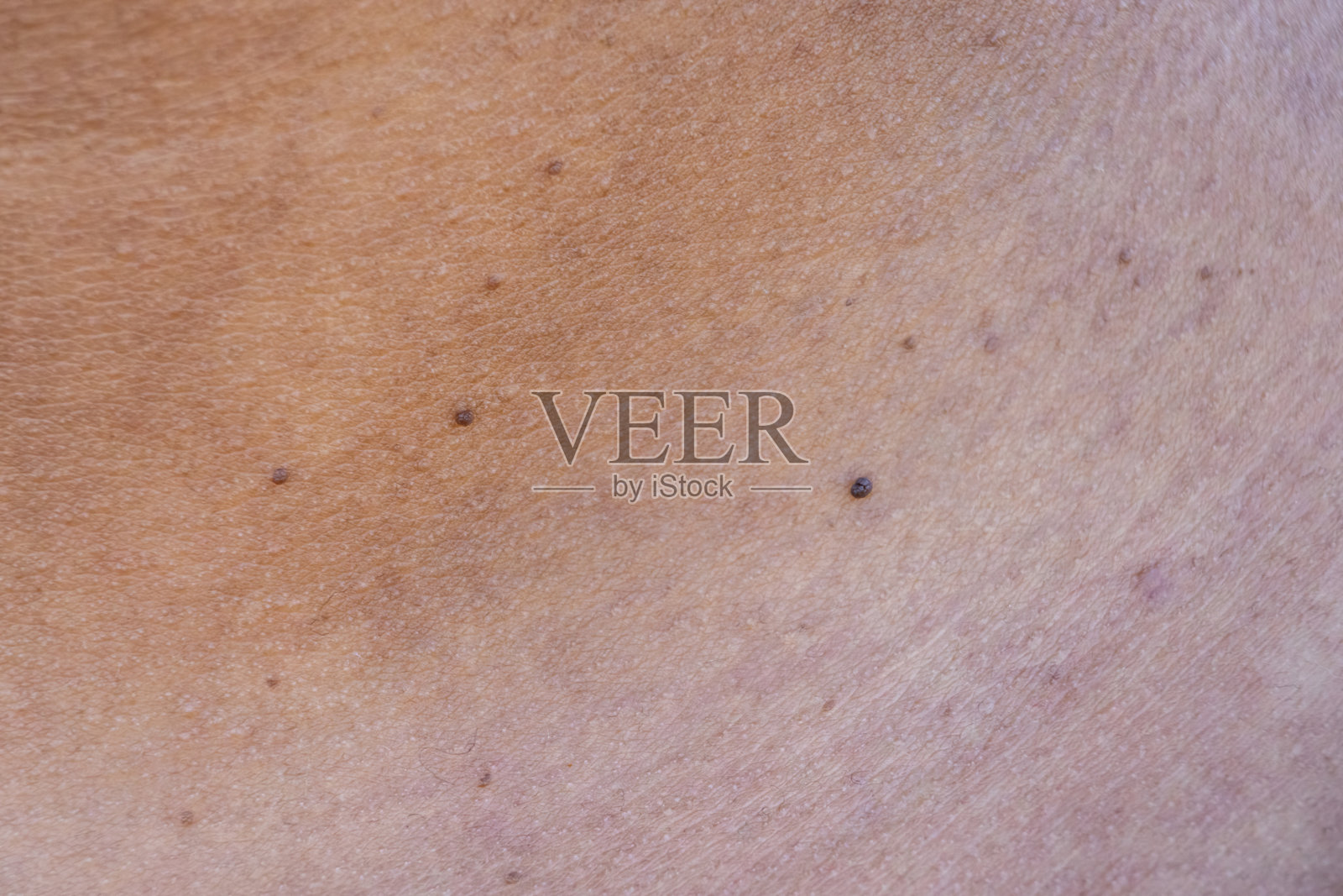 亚洲女性脖子上的皮肤赘生物特写。由于皮肤老化导致胶原蛋白流失。皮肤修复和治疗概念。照片摄影图片