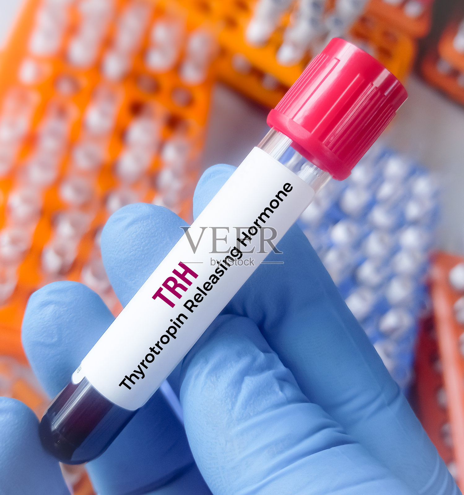 甲状腺功能测试的血样，TSH（促甲状腺激素）用于诊断患者的甲亢或甲减。医学检测概念。TRH（促甲状腺激素释放激素）。照片摄影图片