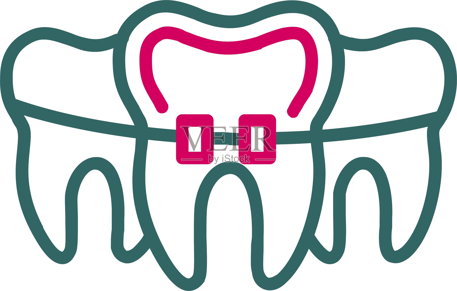 两色图标的牙套线插画图片素材