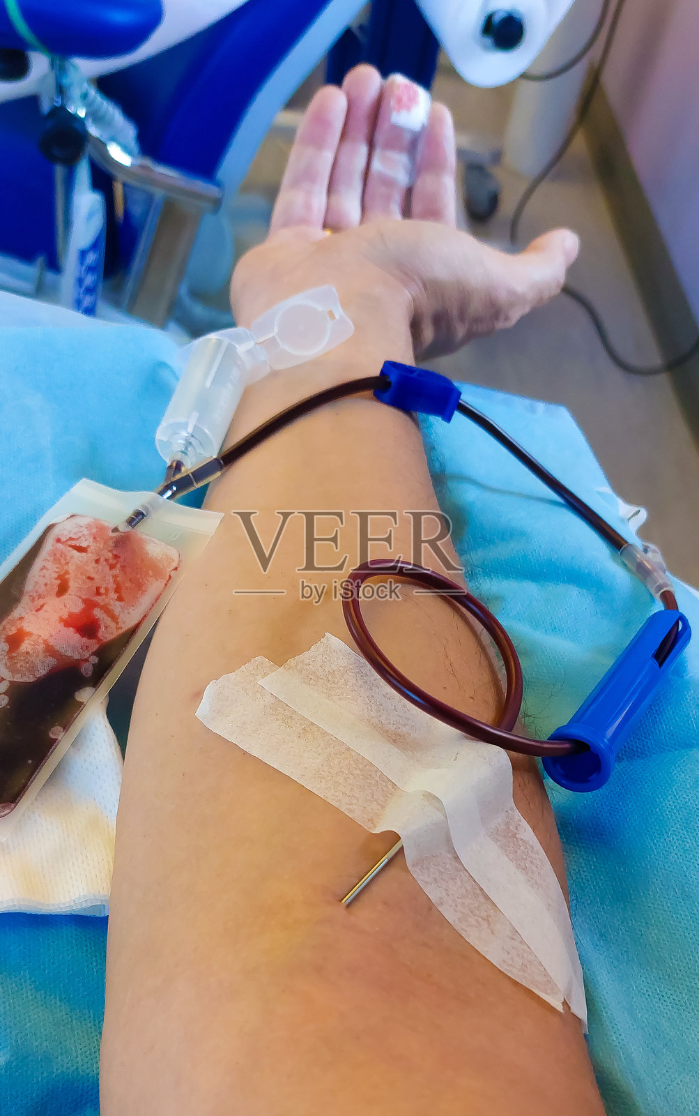 医院里手臂插着针头的献血者照片摄影图片