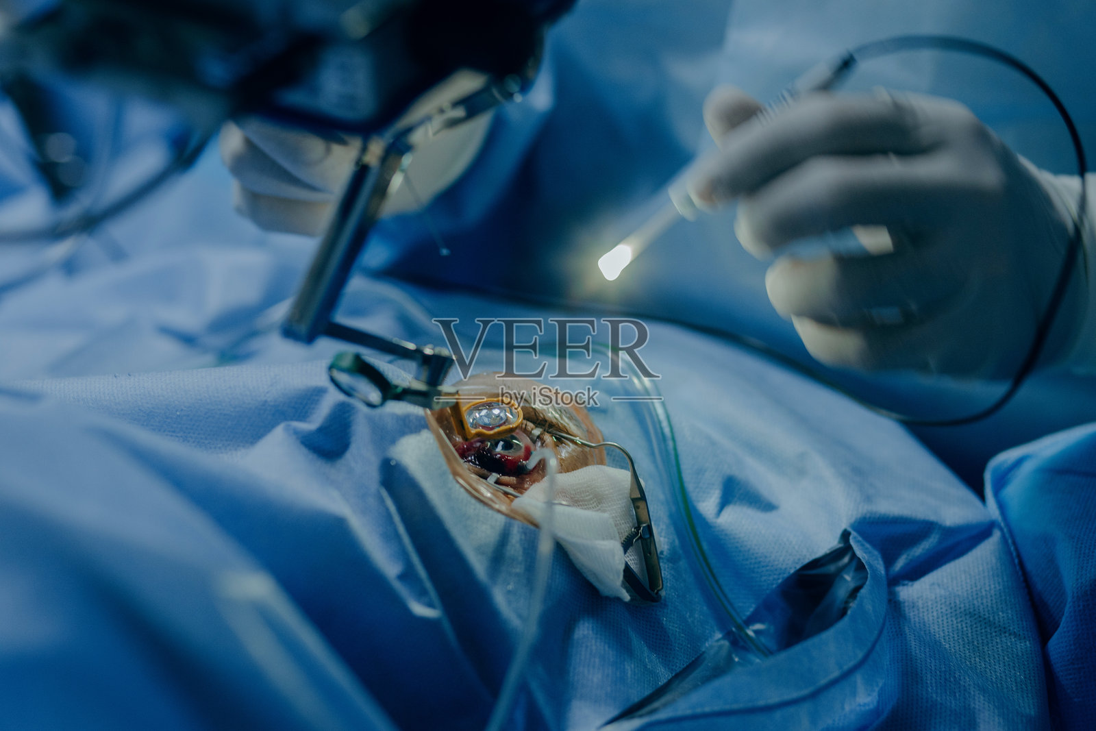 现代诊所中的眼科手术。视力矫正照片摄影图片