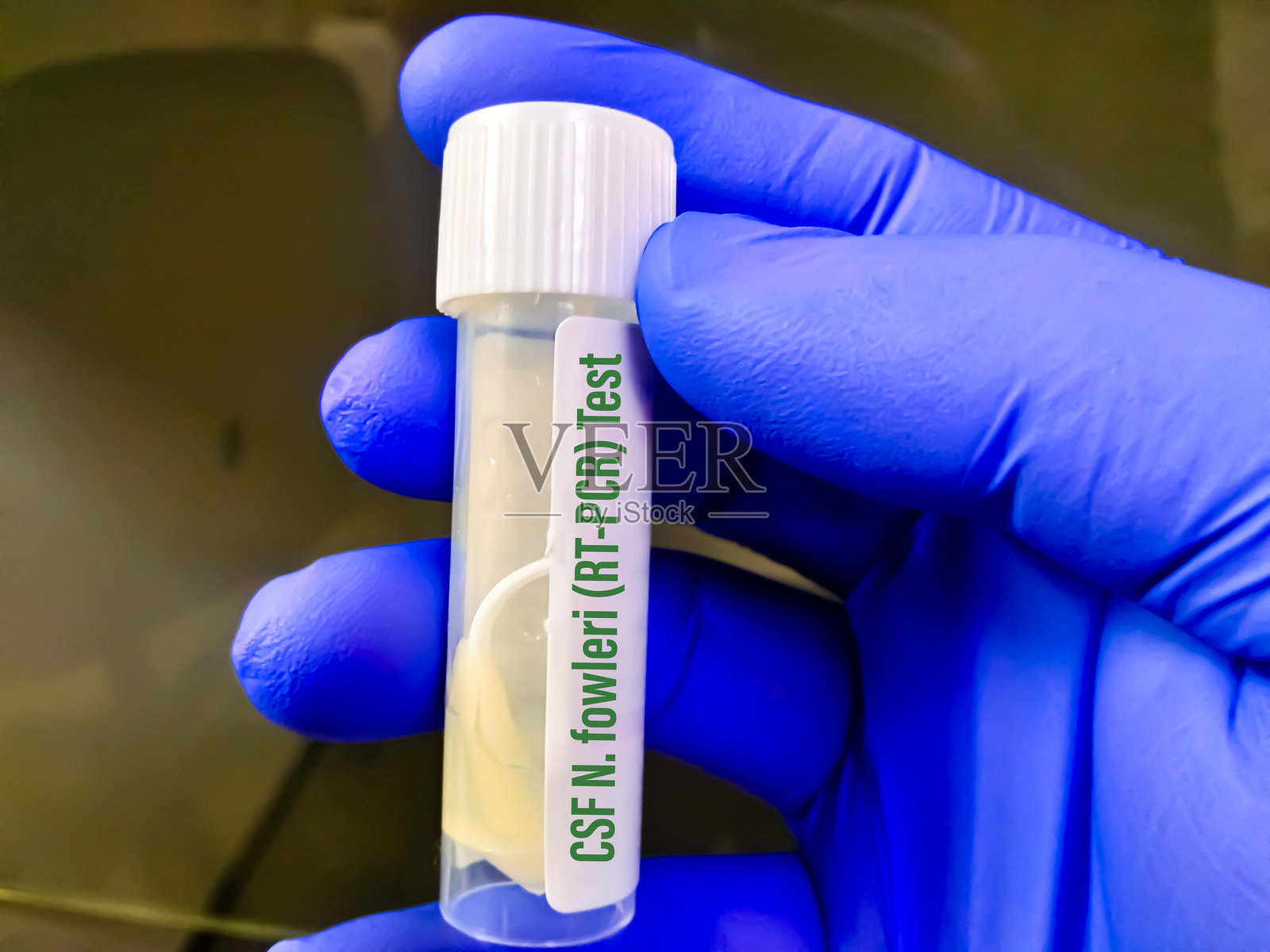 脑脊液（CSF）检测概念。照片摄影图片