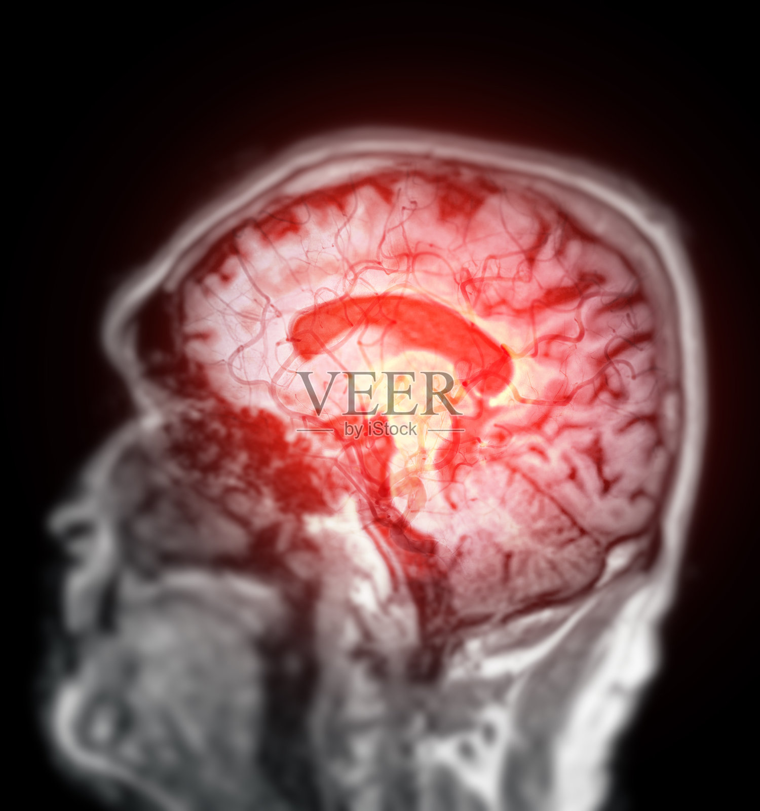脑部MRI扫描，红色高亮区域可能表示关注的部位。适用于神经诊断、医学研究和教育内容。照片摄影图片