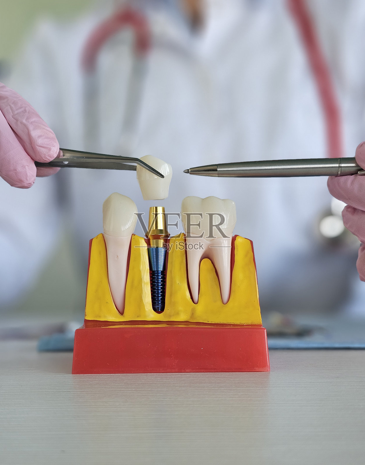 牙科专业人士使用模型演示牙齿植入手术照片摄影图片