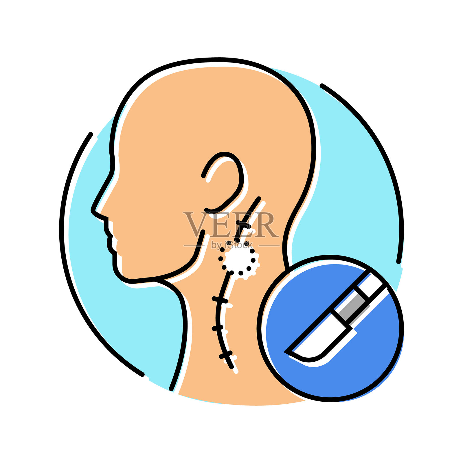 淋巴结切除手术彩色图标矢量插图插画图片素材