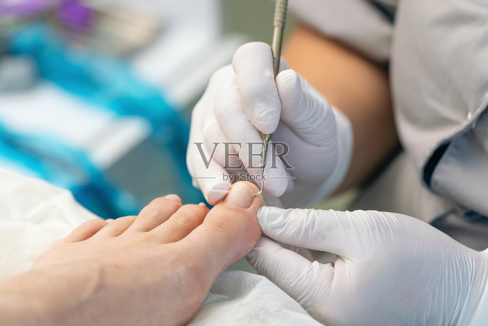 足病医生使用刮匙去除脚趾上的茧。照片摄影图片