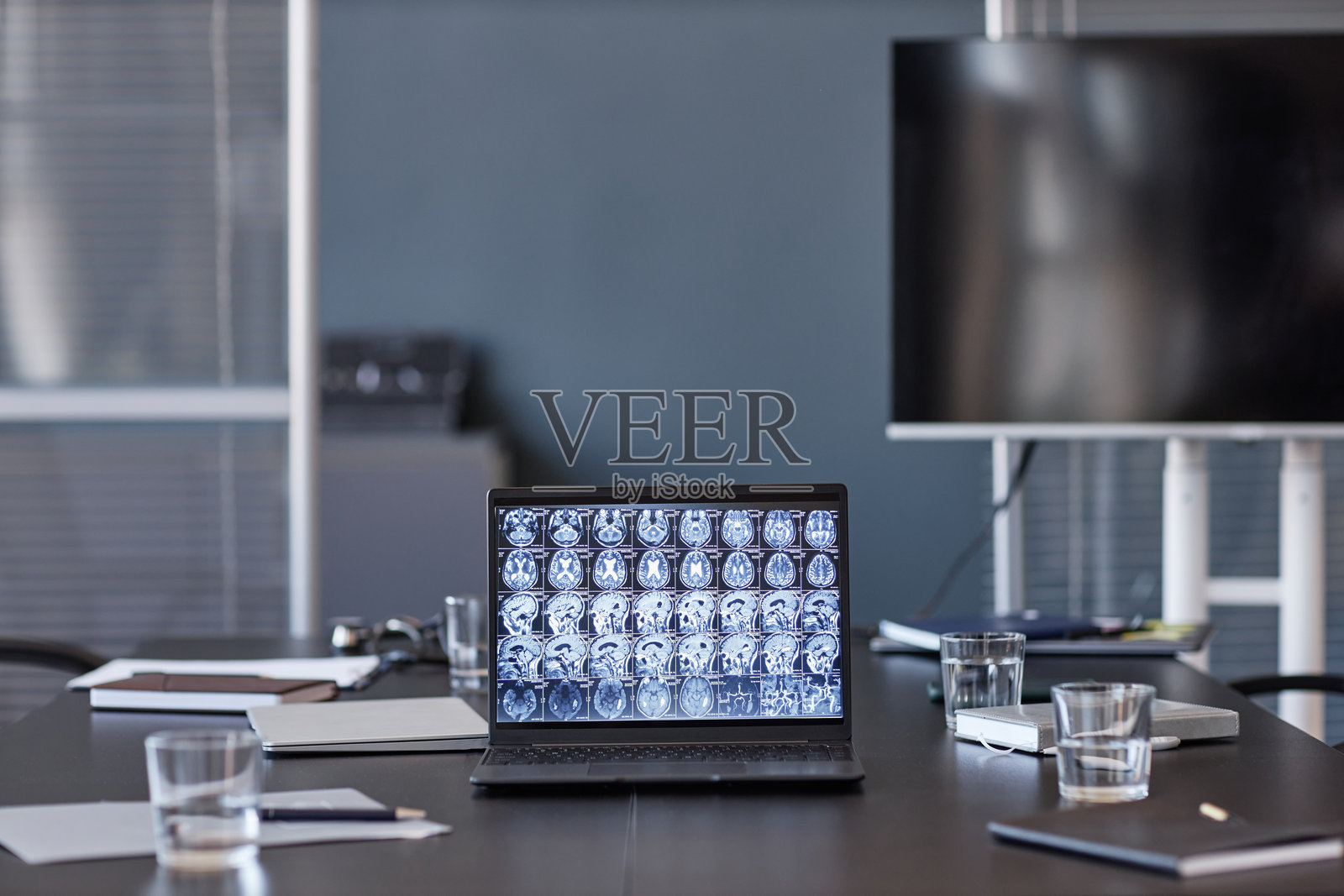 神经科医生的笔记本电脑在医疗办公室的桌子上显示人脑的X光扫描图像照片摄影图片