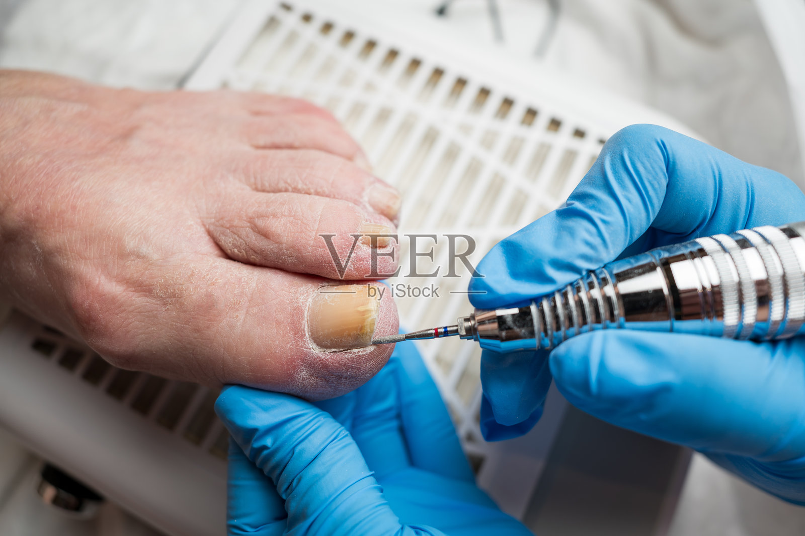 专业的足部护理，老年女性脚部干裂皮肤，嵌甲问题，在足病医生的预约中，足病学和足部护理概念照片摄影图片