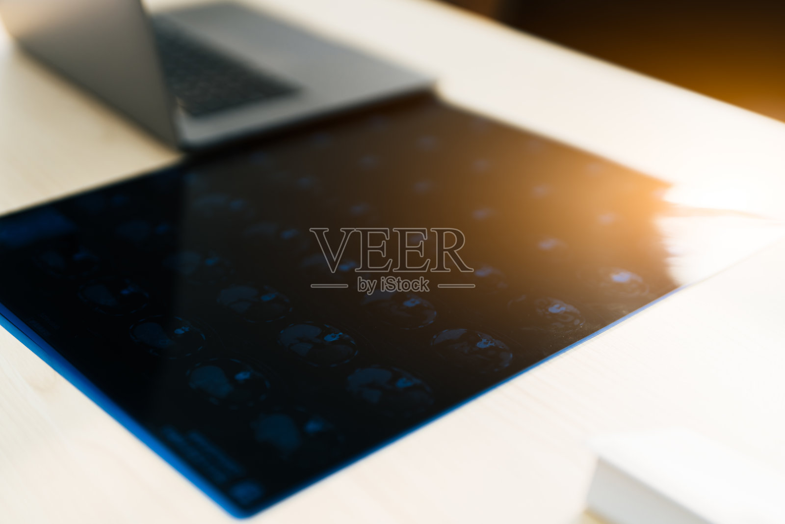 阳光下桌子上的X光图像和笔记本电脑特写。照片摄影图片