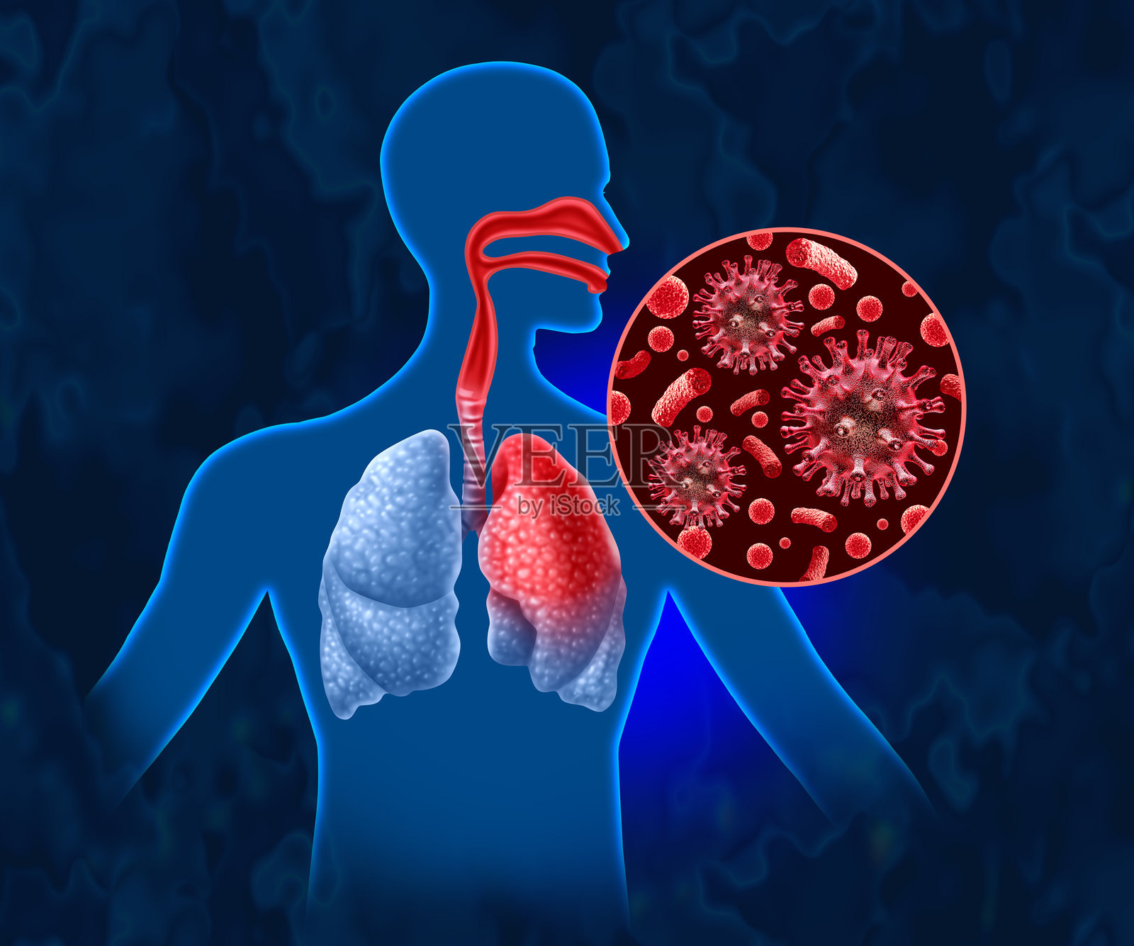 急性呼吸道疾病照片摄影图片