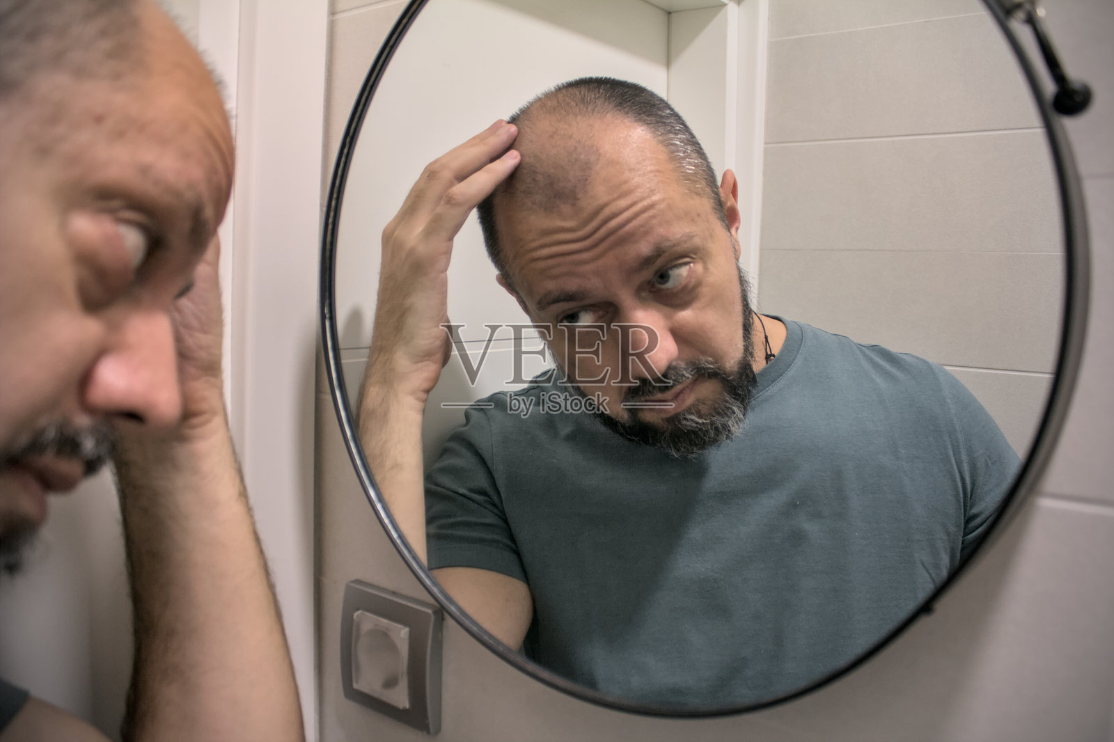 脱发概念照片摄影图片