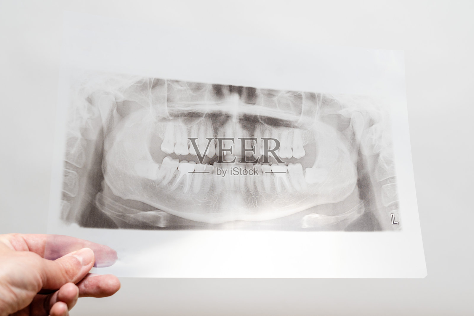 颌部的放射线视图。患者口腔内牙齿的牙科X光片照片摄影图片
