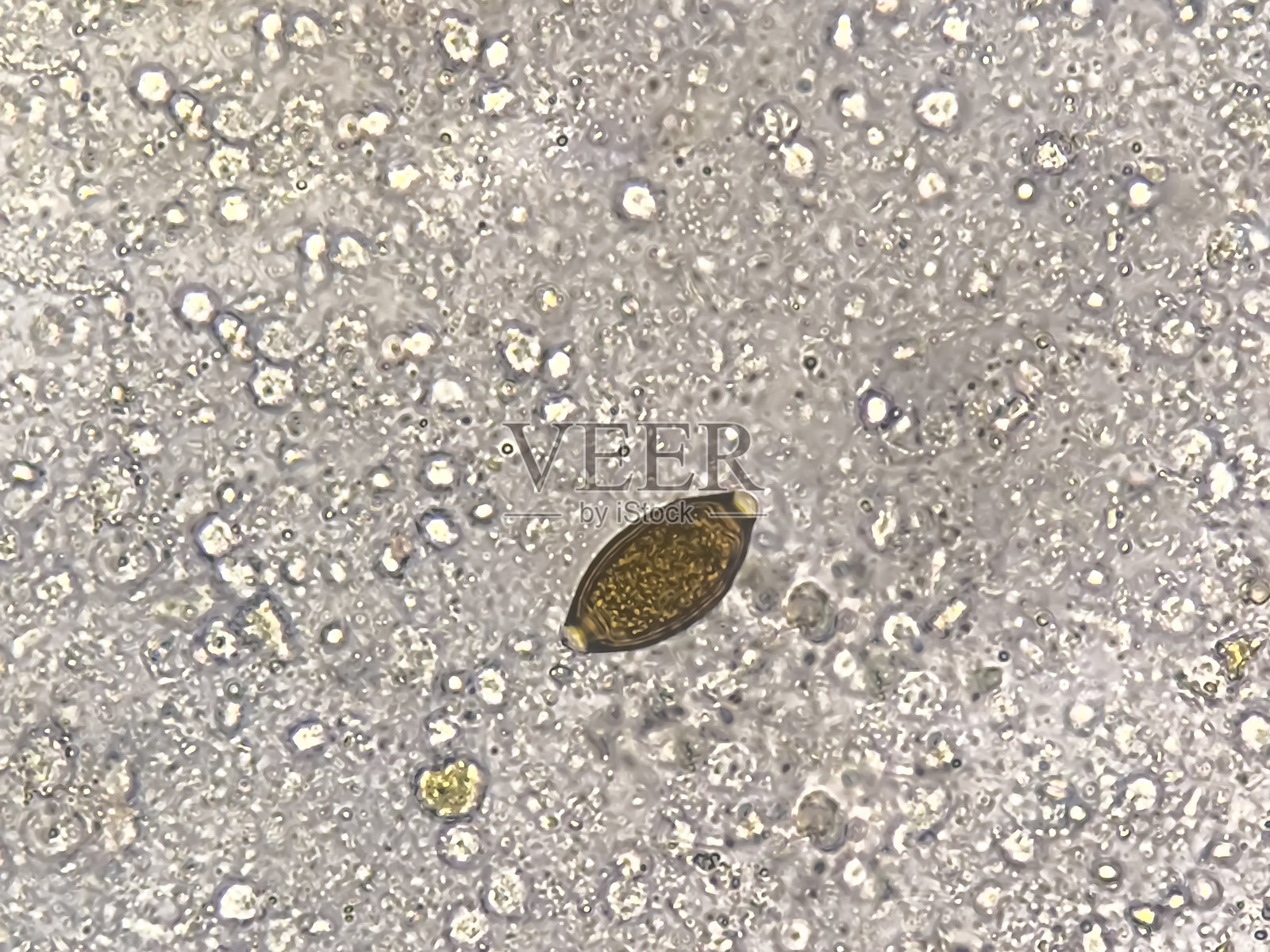 在粪便中观察到的鞭虫（Trichuris trichiura）卵，使用显微镜进行分析照片摄影图片