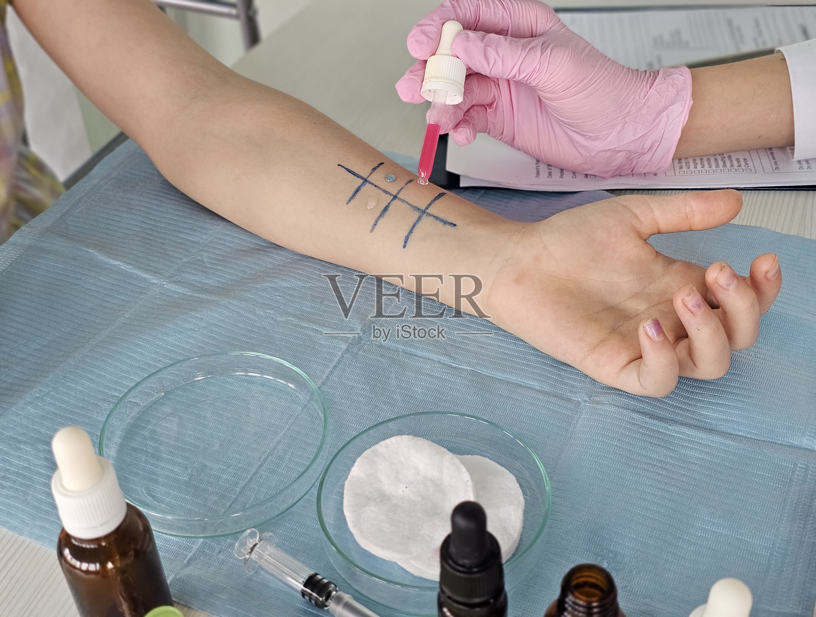 临床环境中进行过敏检测的皮肤测试程序与浓度照片摄影图片