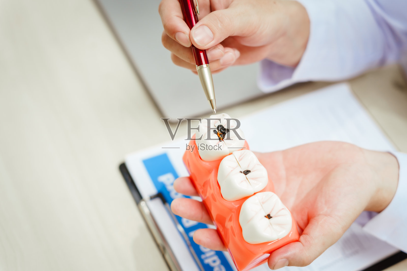 一位戴眼镜的男性医生坐在桌子旁，讲解牙齿蛀牙及其成因，如牙菌斑和糖分，去矿化的过程，以及针对牙齿裂纹、缺失和损坏等问题的解决方案。照片摄影图片