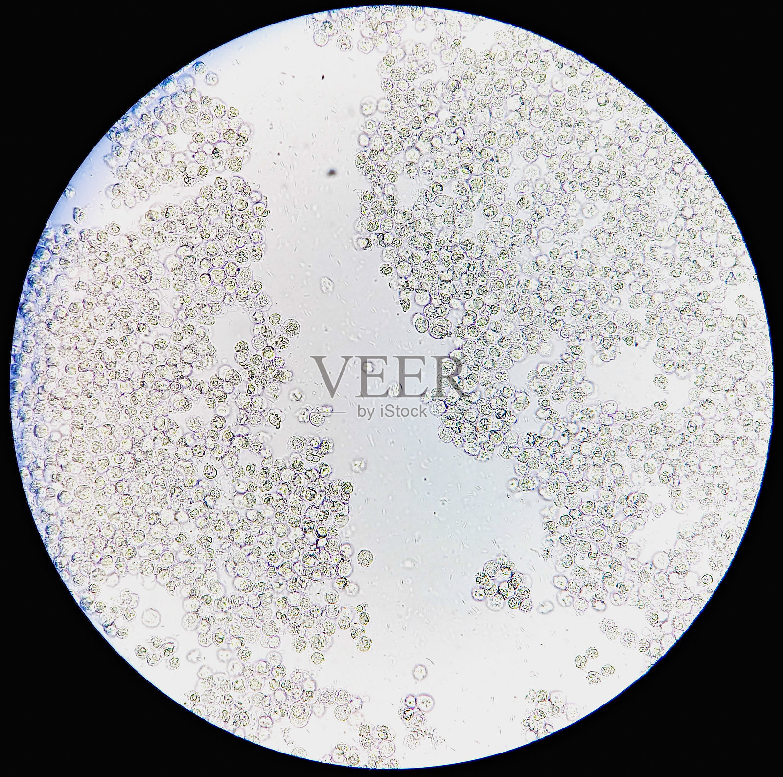 尿液分析的显微照片，显示大量脓细胞，尿路感染。照片摄影图片