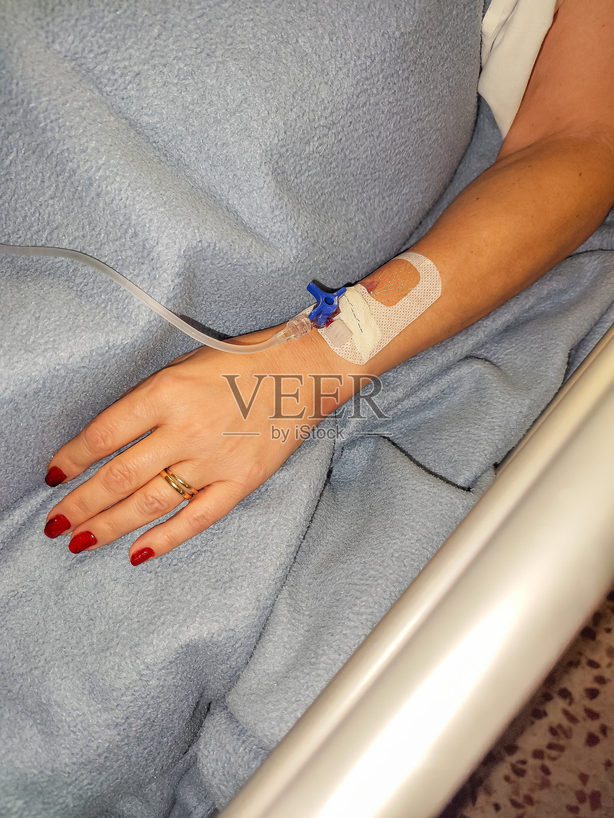 病人手部特写，手放在毯子上，静脉导管用胶带固定，正在接受医疗治疗。照片摄影图片