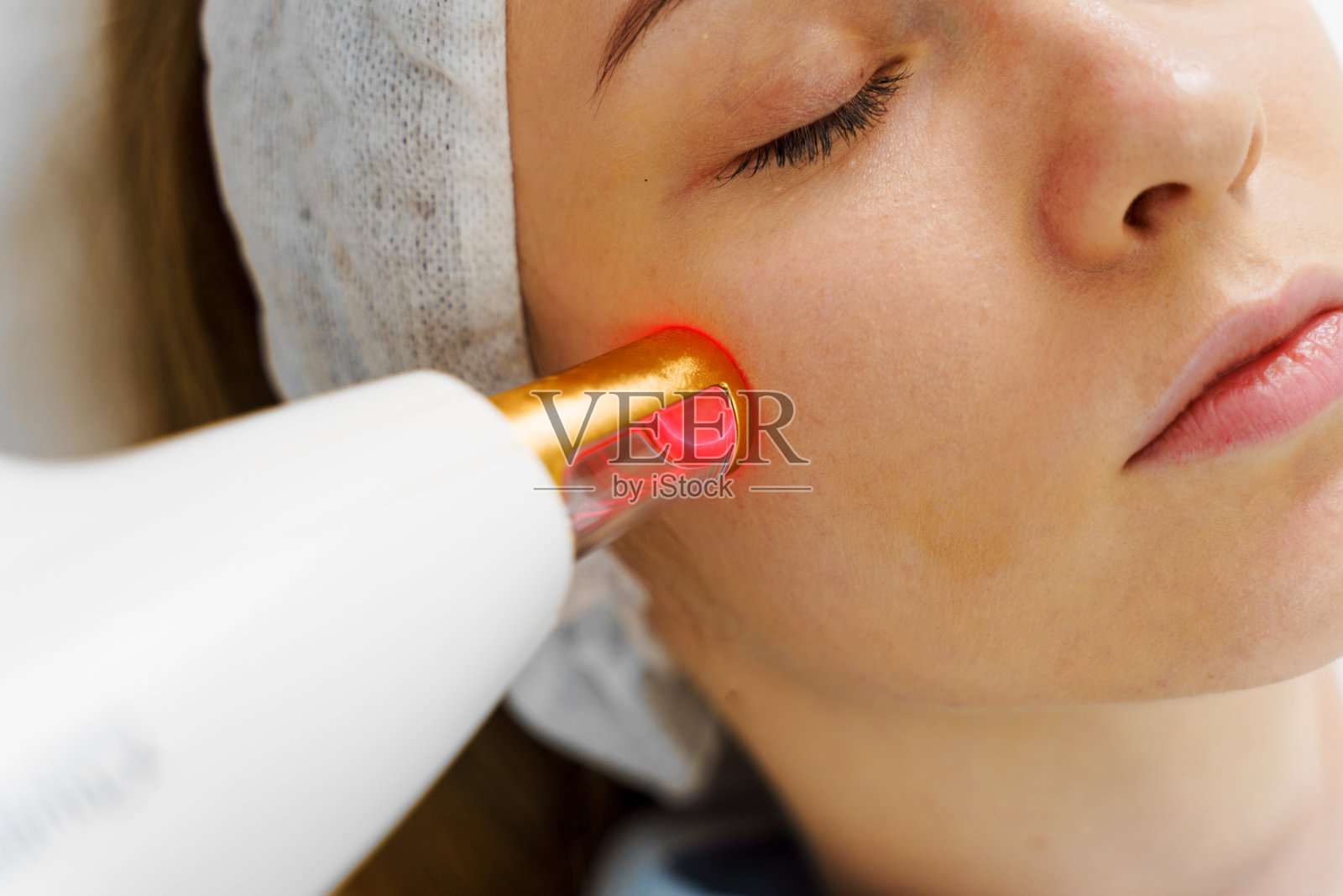 使用IPL超声激光去除患者面部扩张的小血管的玫瑰痤疮。皮肤科医生进行的玫瑰痤疮激光治疗。美容诊所无痛的玫瑰痤疮治疗。照片摄影图片