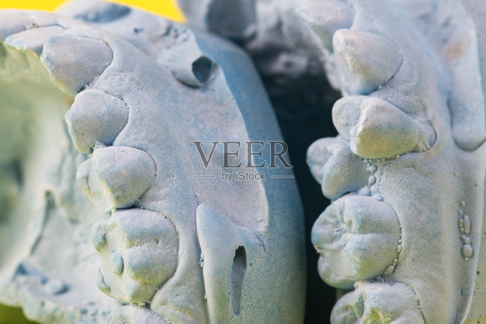 在黄色背景上，病人的牙齿弯曲和咬合错误的蓝色石膏模型。制造各类桥、冠、宏、排齿照片摄影图片