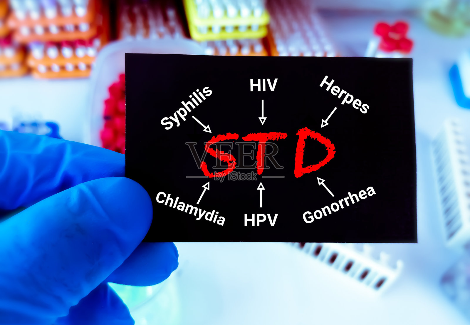 STD(性传播疾病)术语，HIV，梅毒，疱疹，HPV，衣原体，淋病。性传播疾病，阻止性传播疾病。医疗保健概念。实验室的背景。照片摄影图片