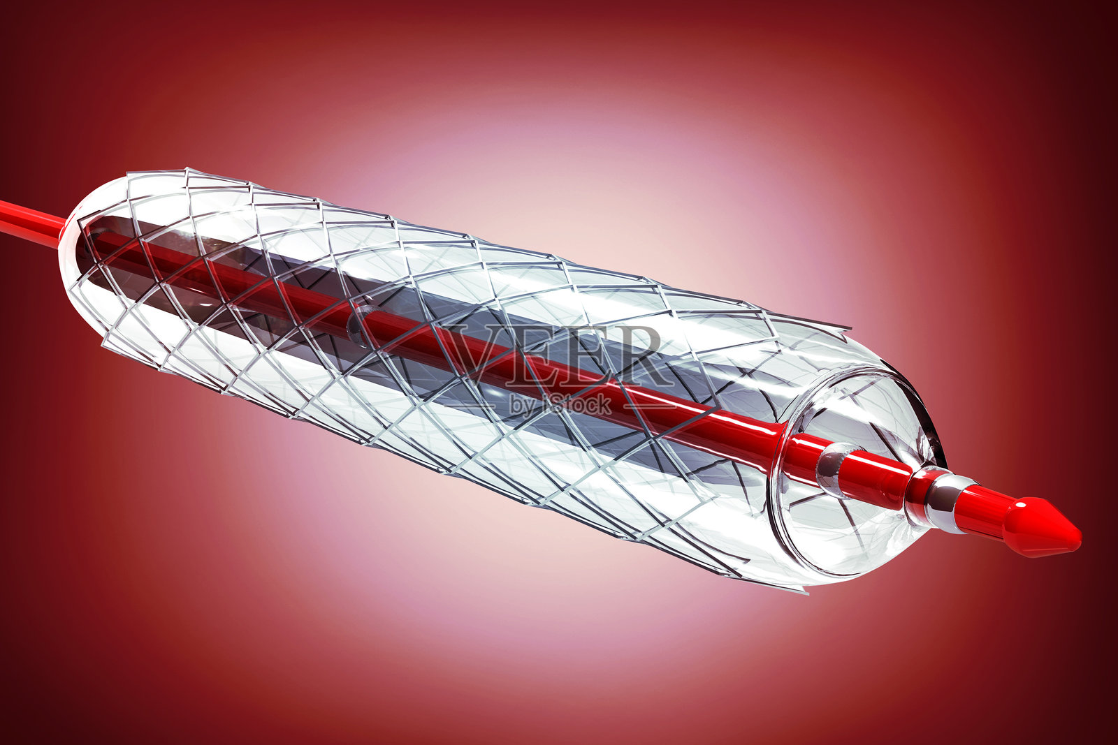 带气囊的支架成形术。3D插图照片摄影图片