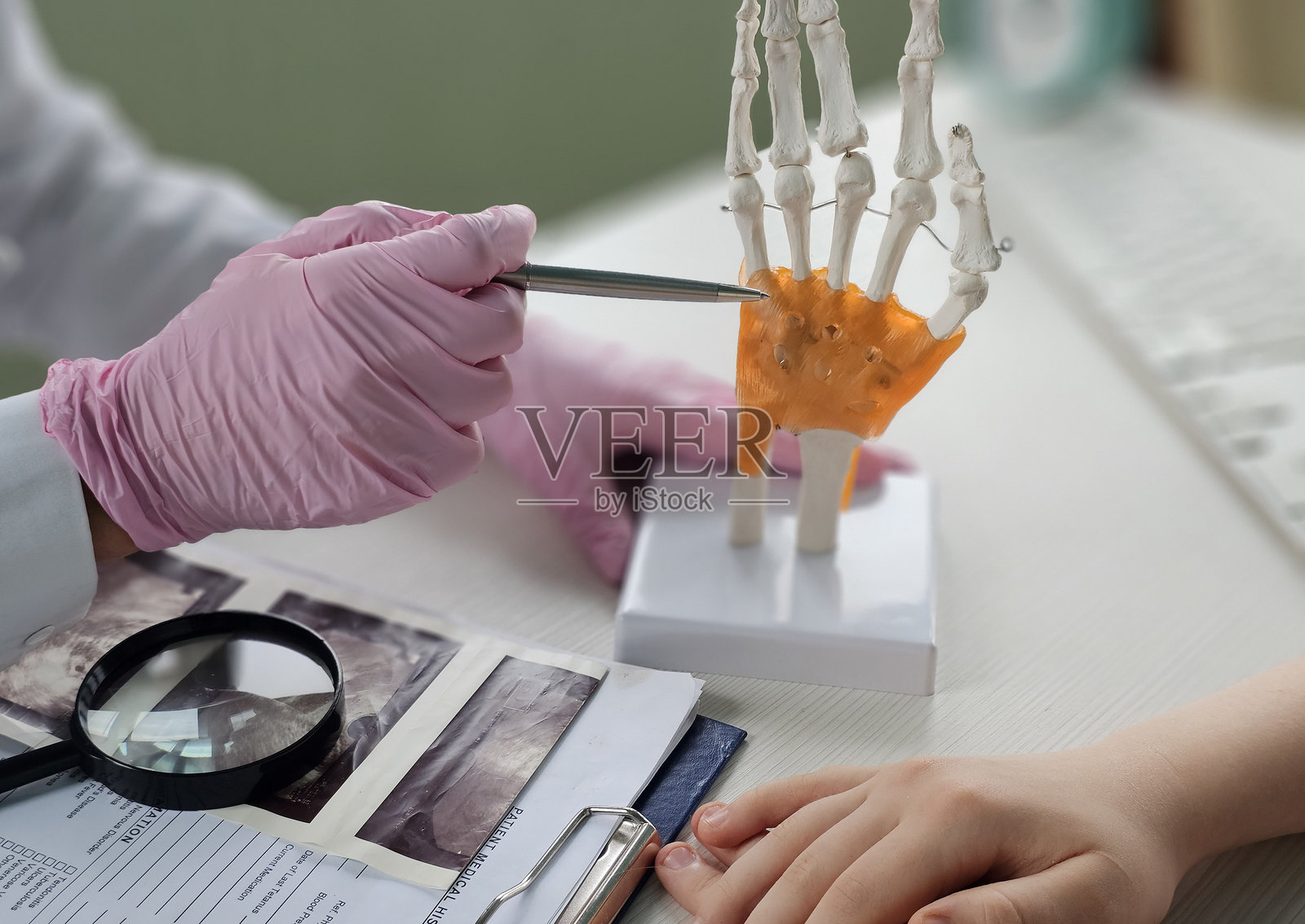 医生在患者咨询期间检查手部模型照片摄影图片